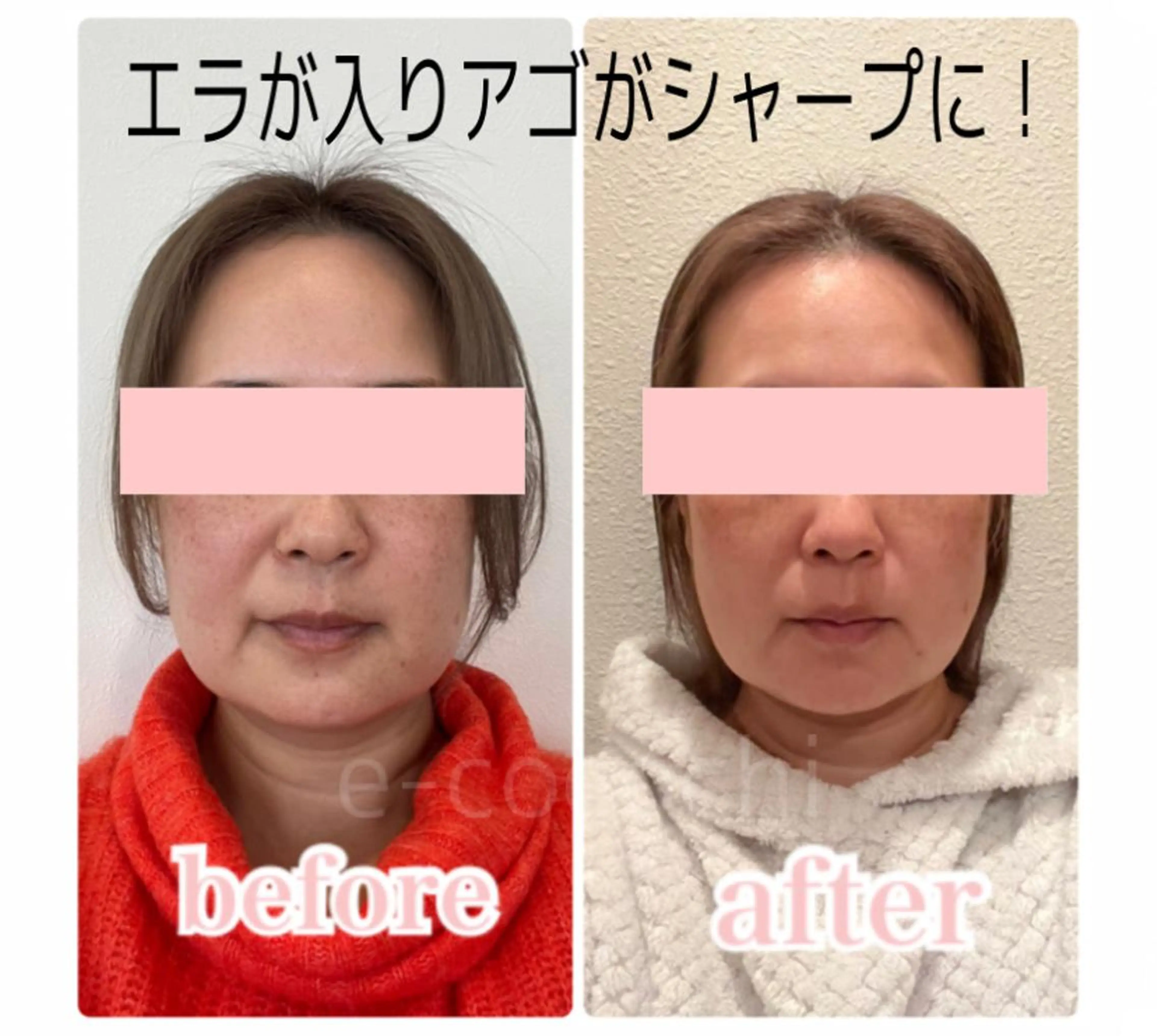 エステ リラク 小顔と ヘッドスパのお店のエステ・リラクイメージ