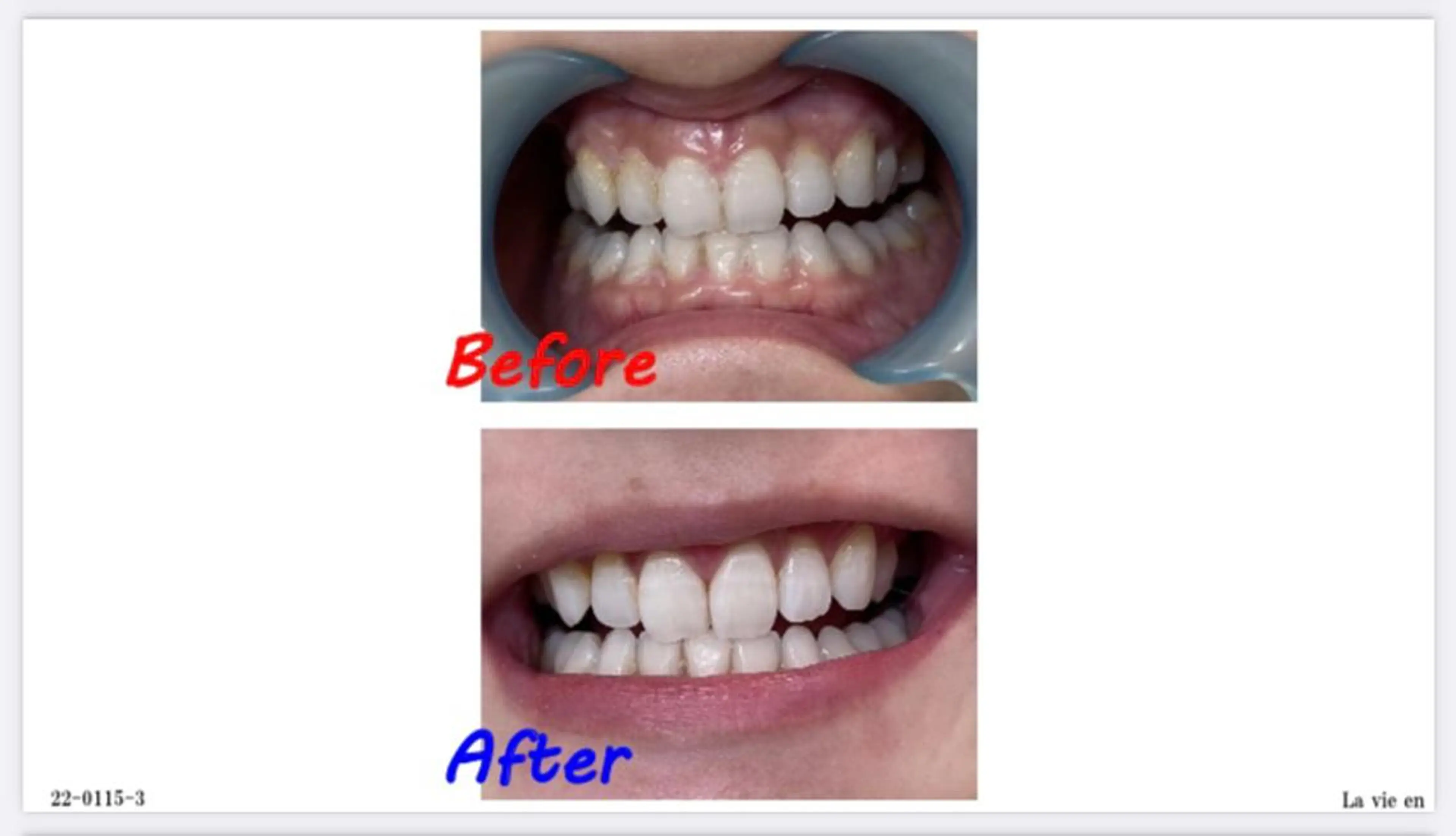 その他 セルフホワイトニングサロン　ラヴィアン所属・ホワイトニングサロン La vie enのその他イメージ