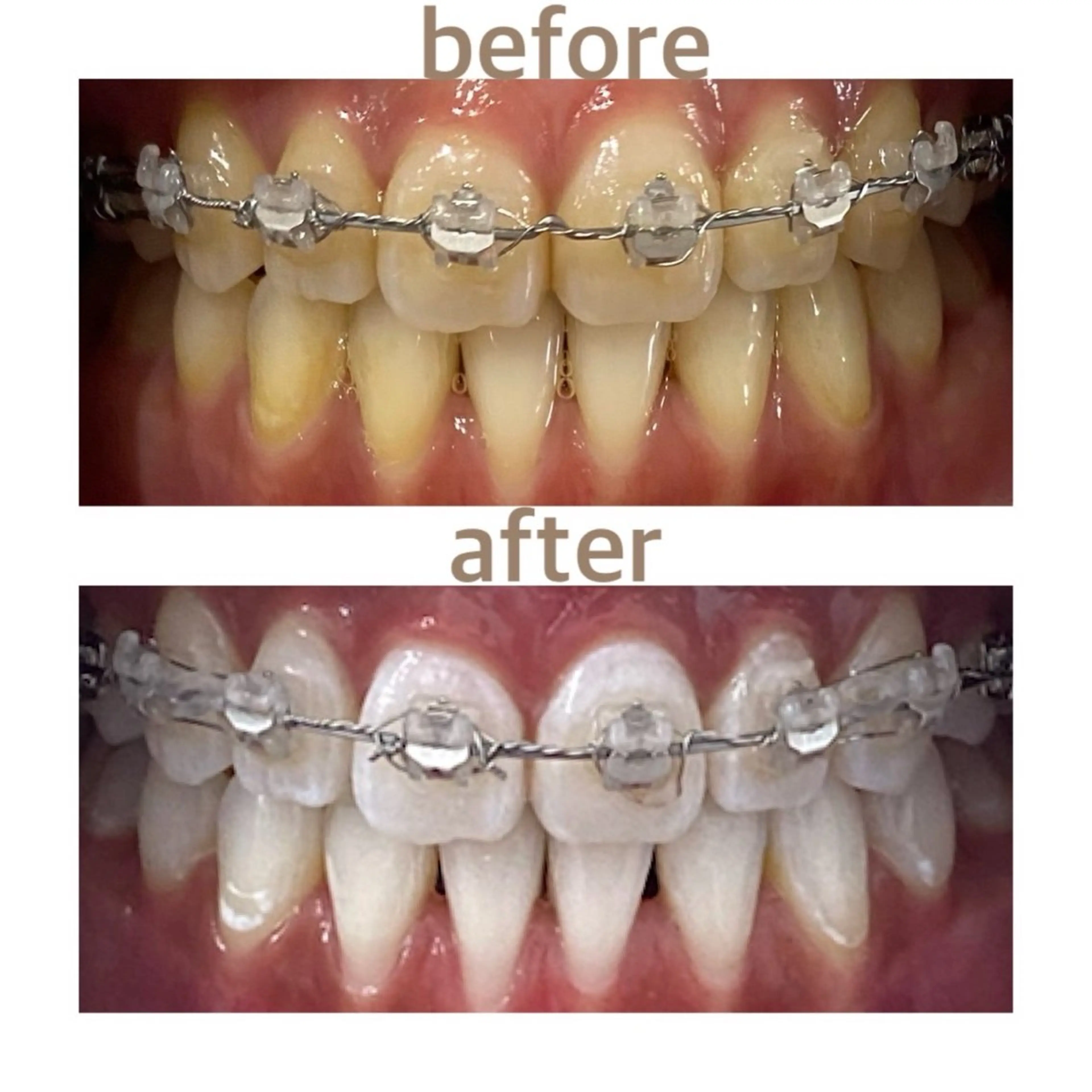 メンズ ホワイトニング ショップ本八幡店のエステ・リラクイメージ