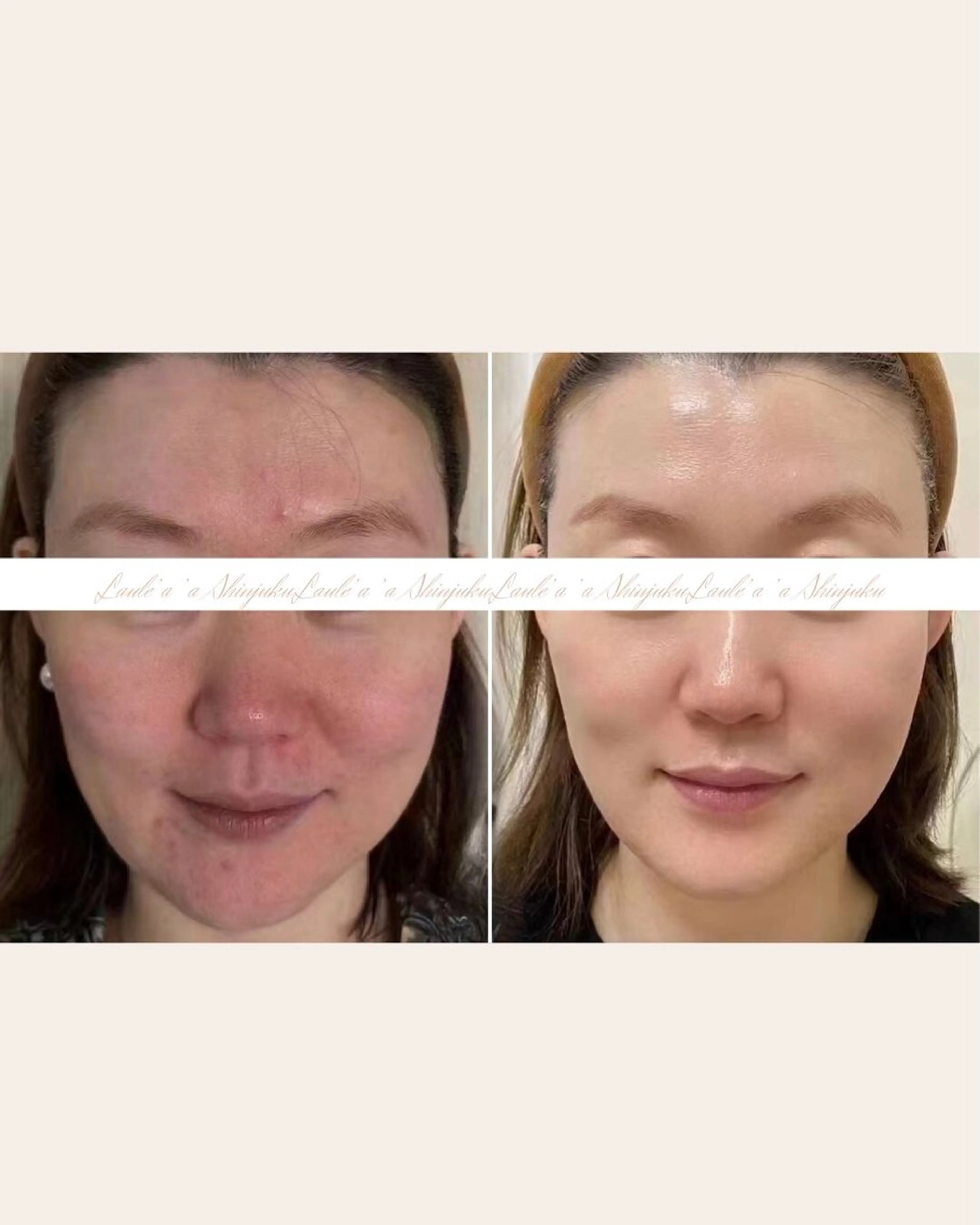 痩身/腸もみ/ ヘッドスパ/リンパのエステ・リラクイメージ