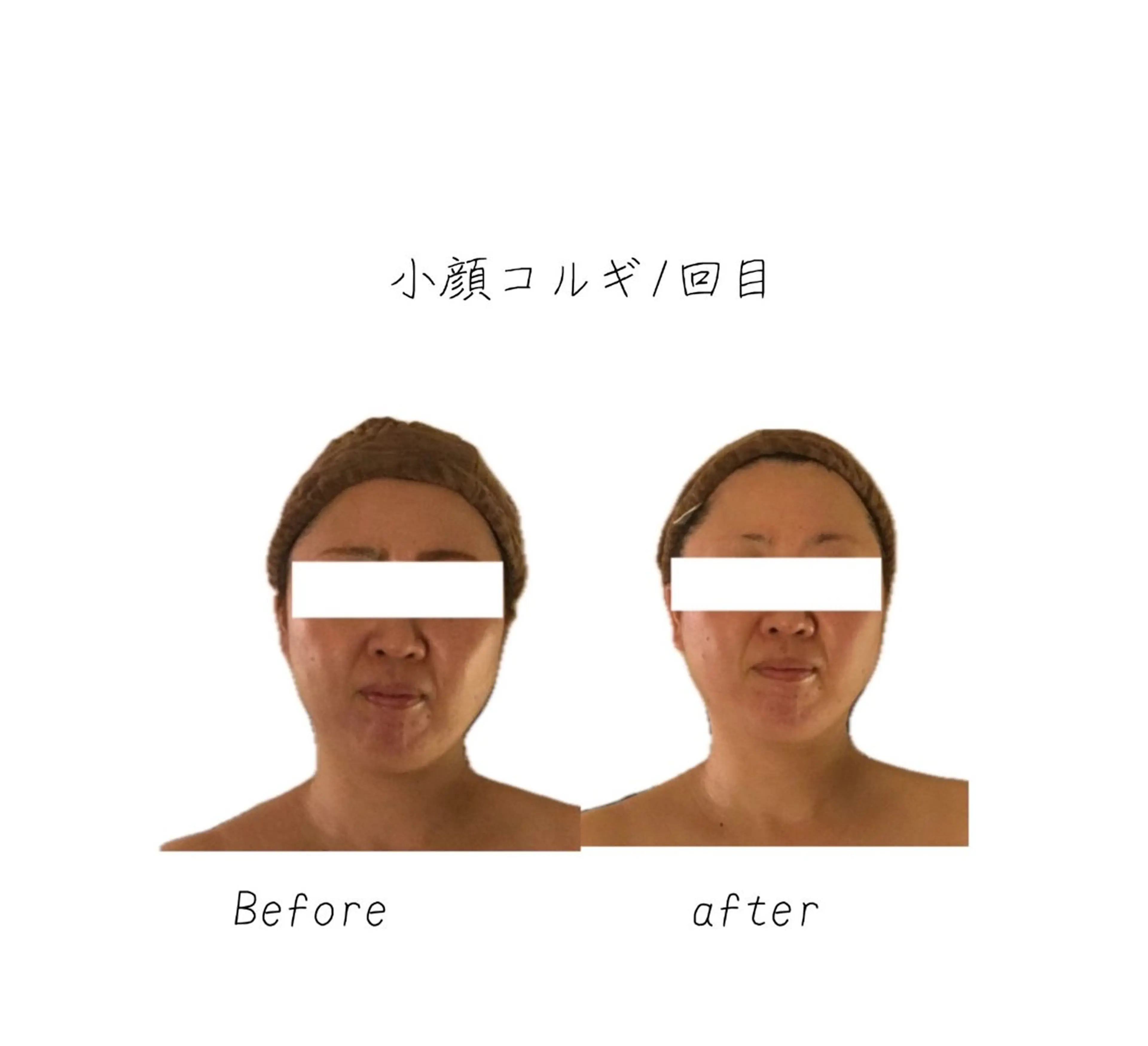 エステ リラク 小顔コルギ専門店/隠れ家サロン《여름ヨルム》所属・小顔コルギ専門店 《ヨルム》龍ケ崎店のエステ・リラクイメージ