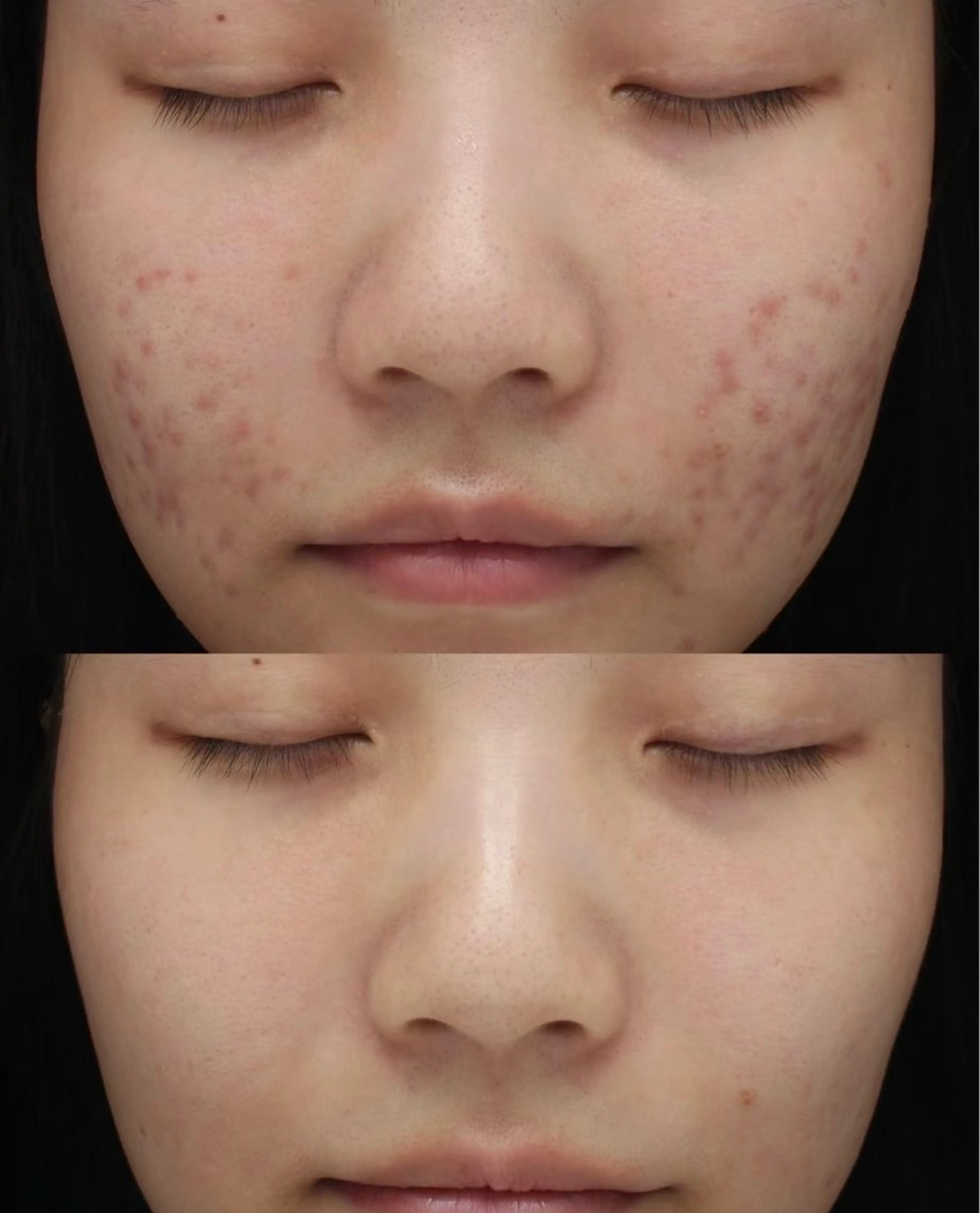 マツエク・マツパ エステ リラク 愛維美水光美肌専門店所属・愛維美水光美肌専門店 メンズレディースokのエステ・リラクイメージ