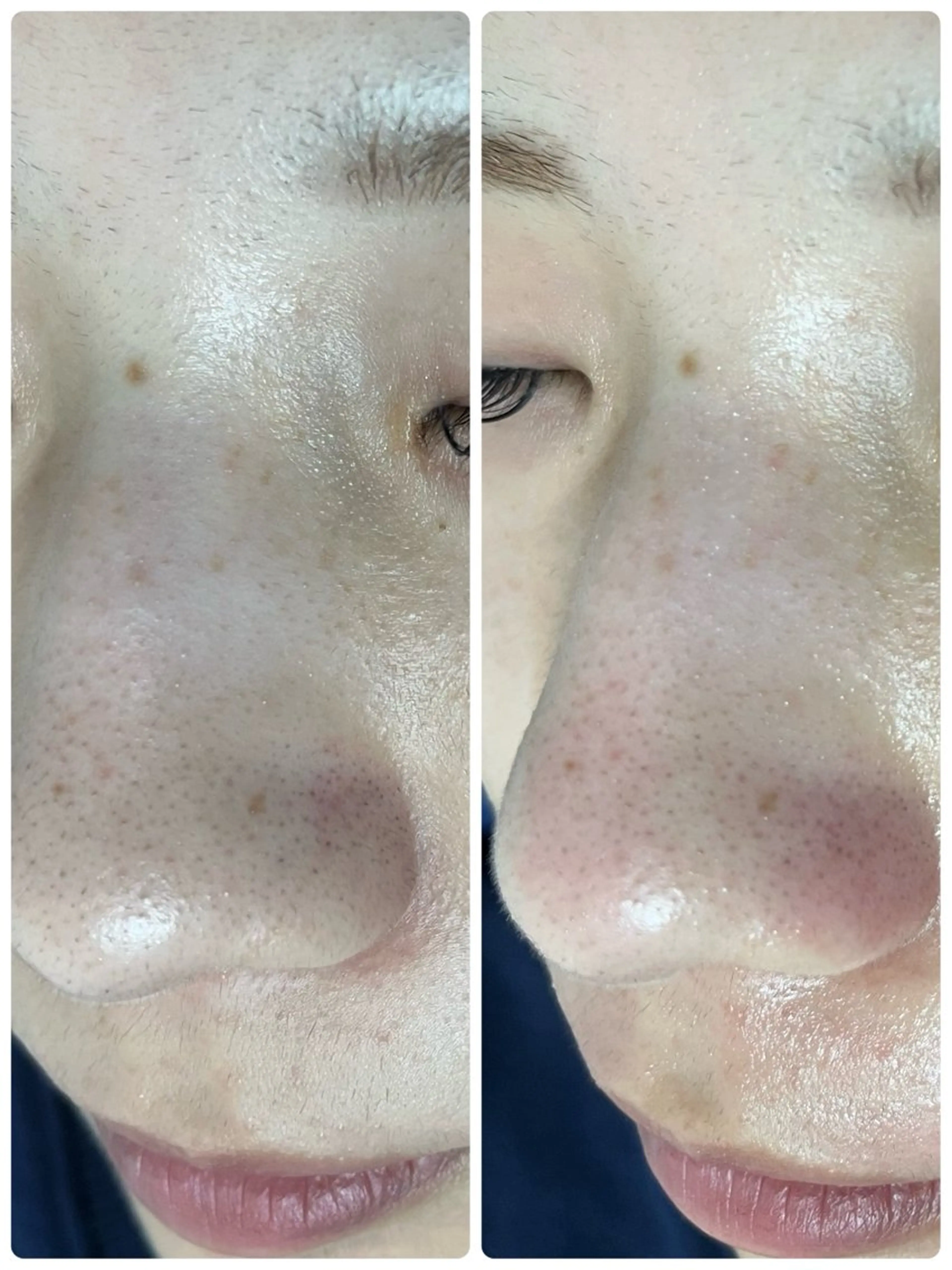 《全顔フェイシャルWAX＋鎮静保湿ケア》の写真