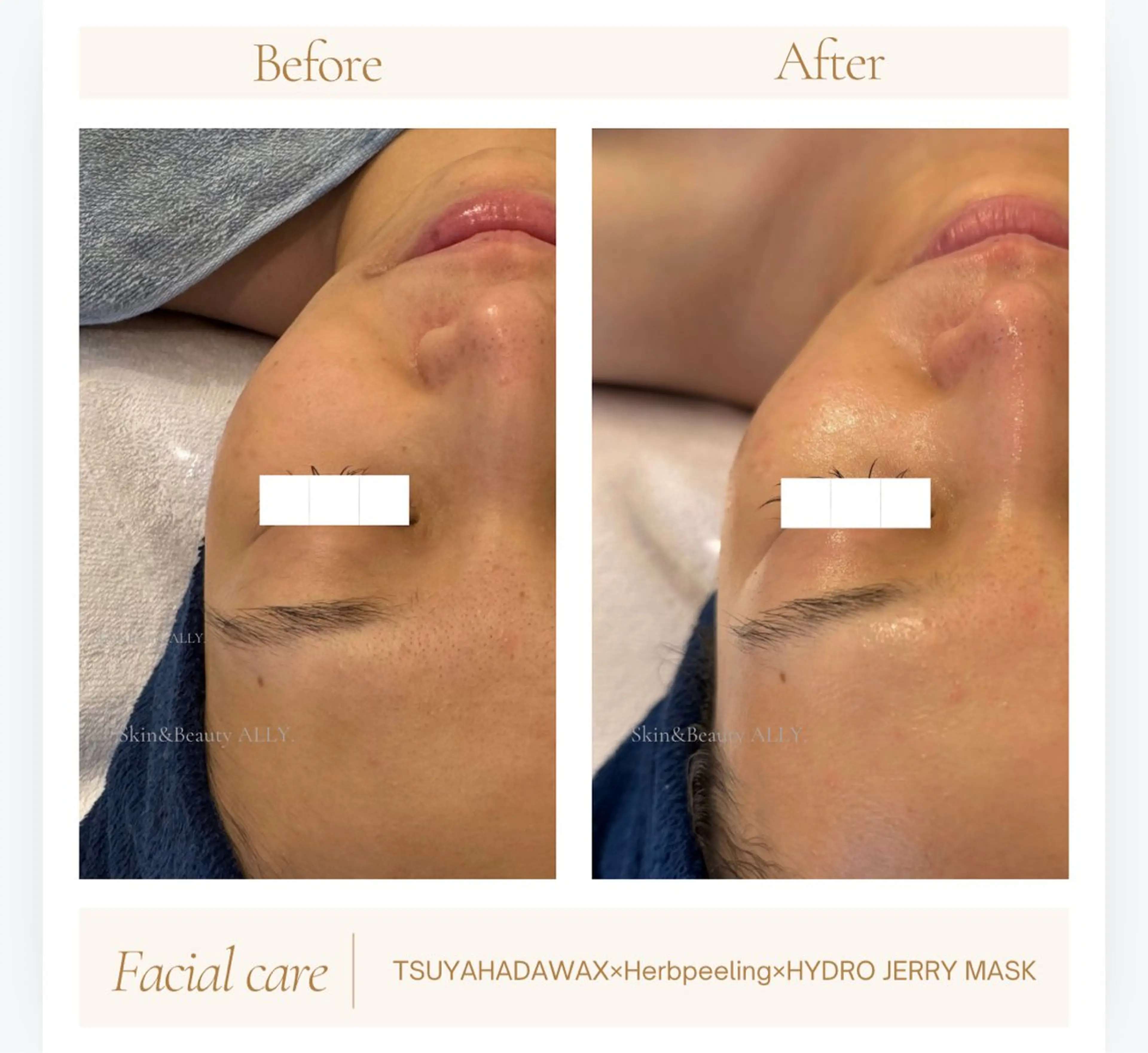 エステ 艶肌ワックス ALLY.のエステ・リラクイメージ