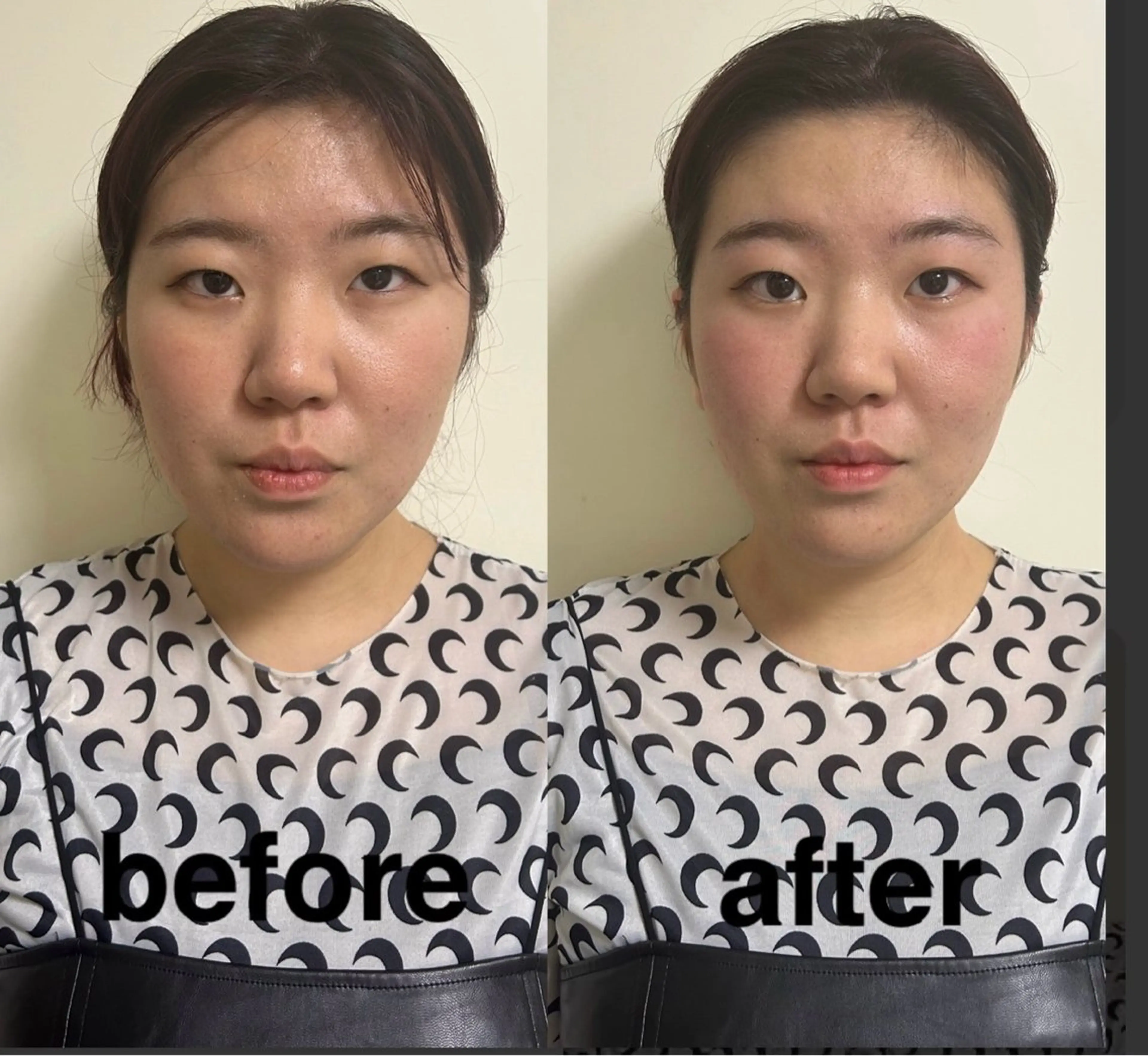 エステ リラク 美容鍼灸サロン mahoroba院長のエステ・リラクイメージ