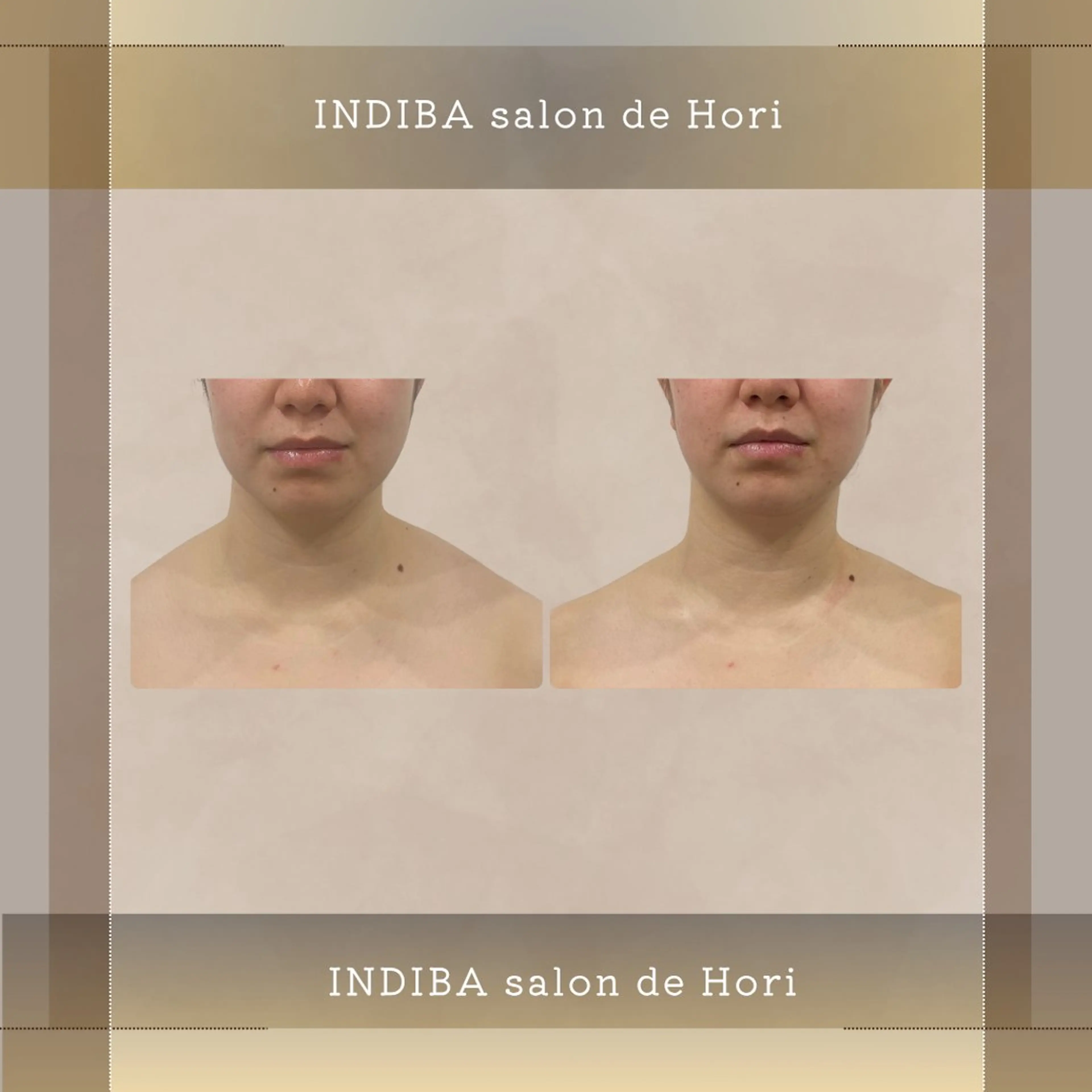 メンズ INDIBA Salon小澤るいのエステ・リラクイメージ