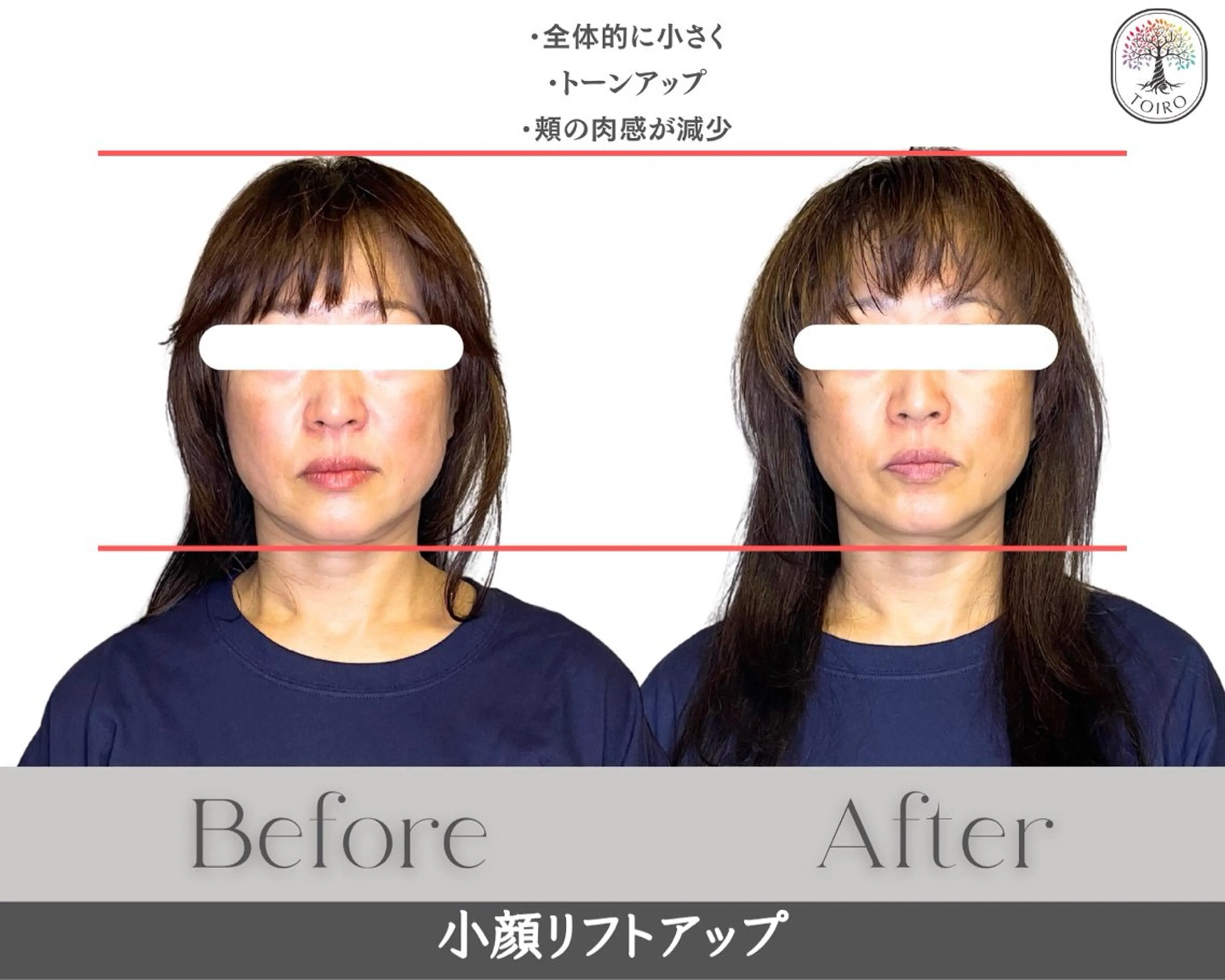 エステ ヘッドスパ・小顔矯正　十色　横浜所属・ヘッドスパ・小顔矯正 十色　横浜のエステ・リラクイメージ