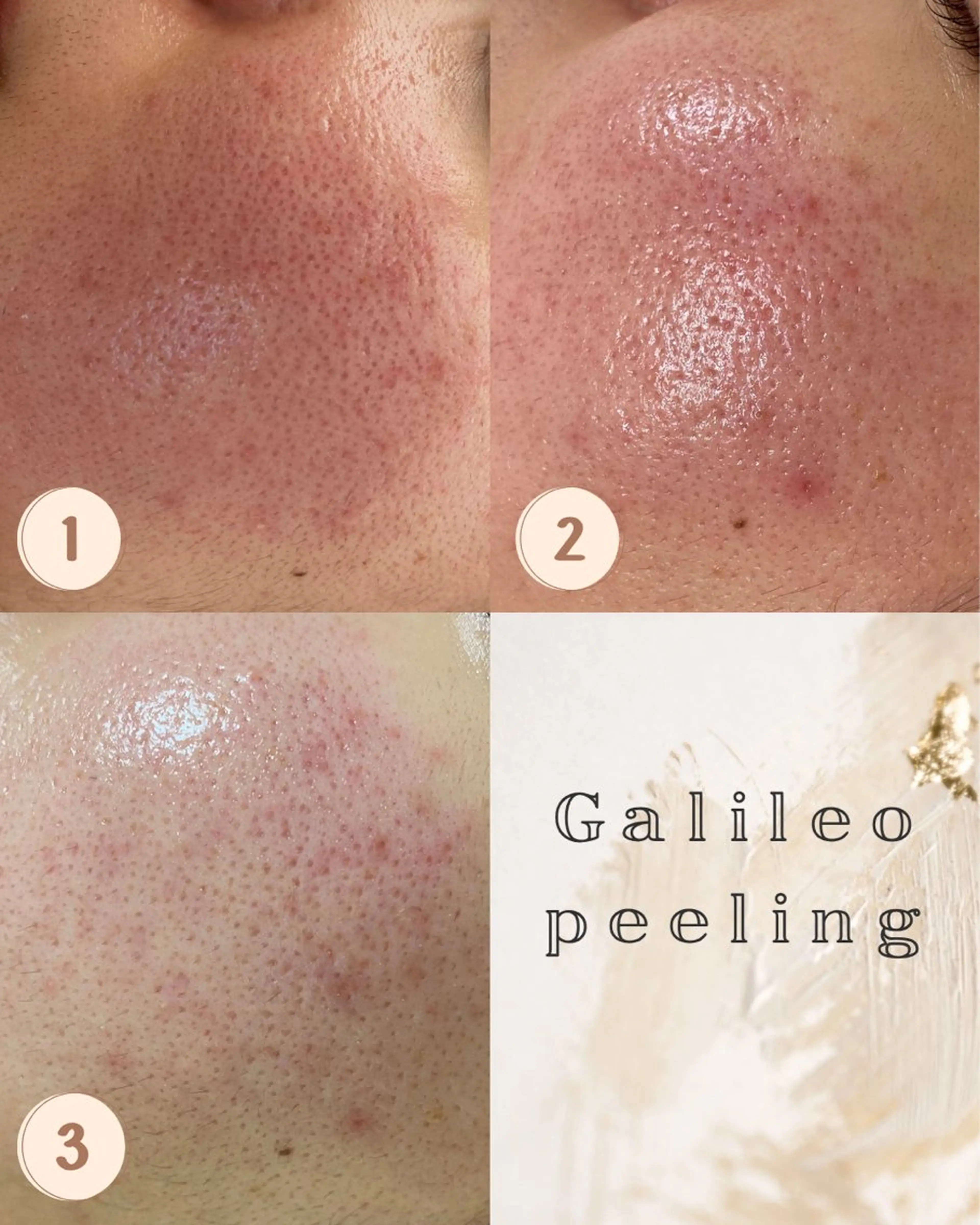 エステ Life＆ Beautifulのエステ・リラクイメージ