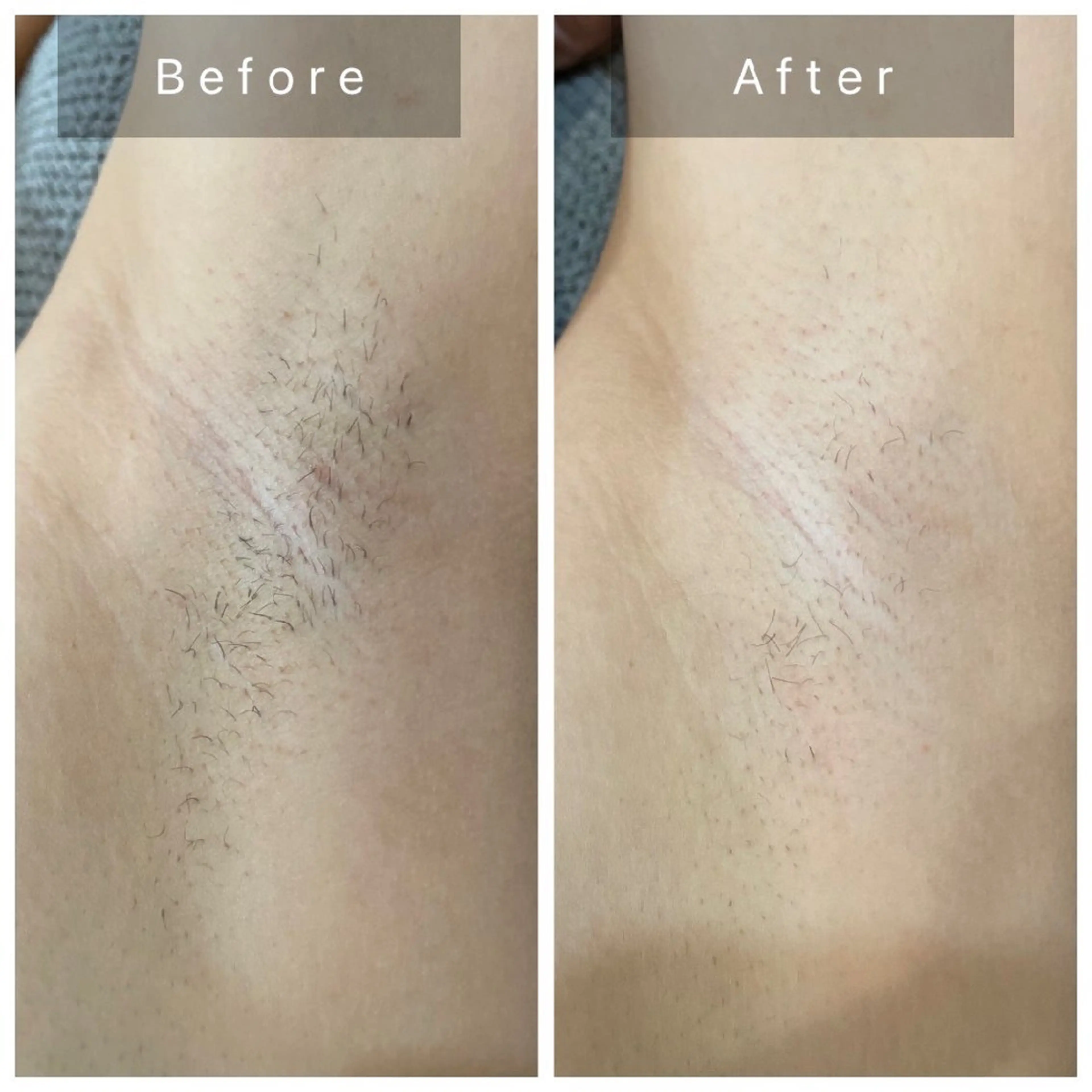 salon Lewis Addict所属・ルイスアディクト 名駅店のエステ・リラクイメージ