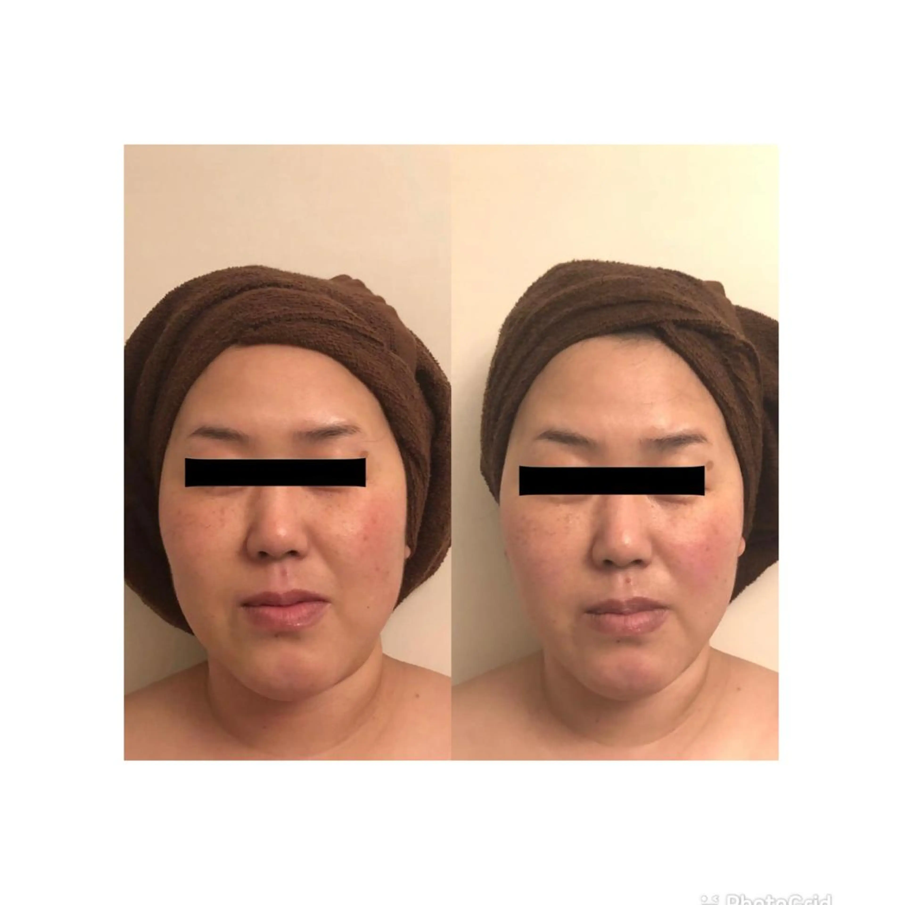 おうちサロン B-ROOMのエステ・リラクイメージ