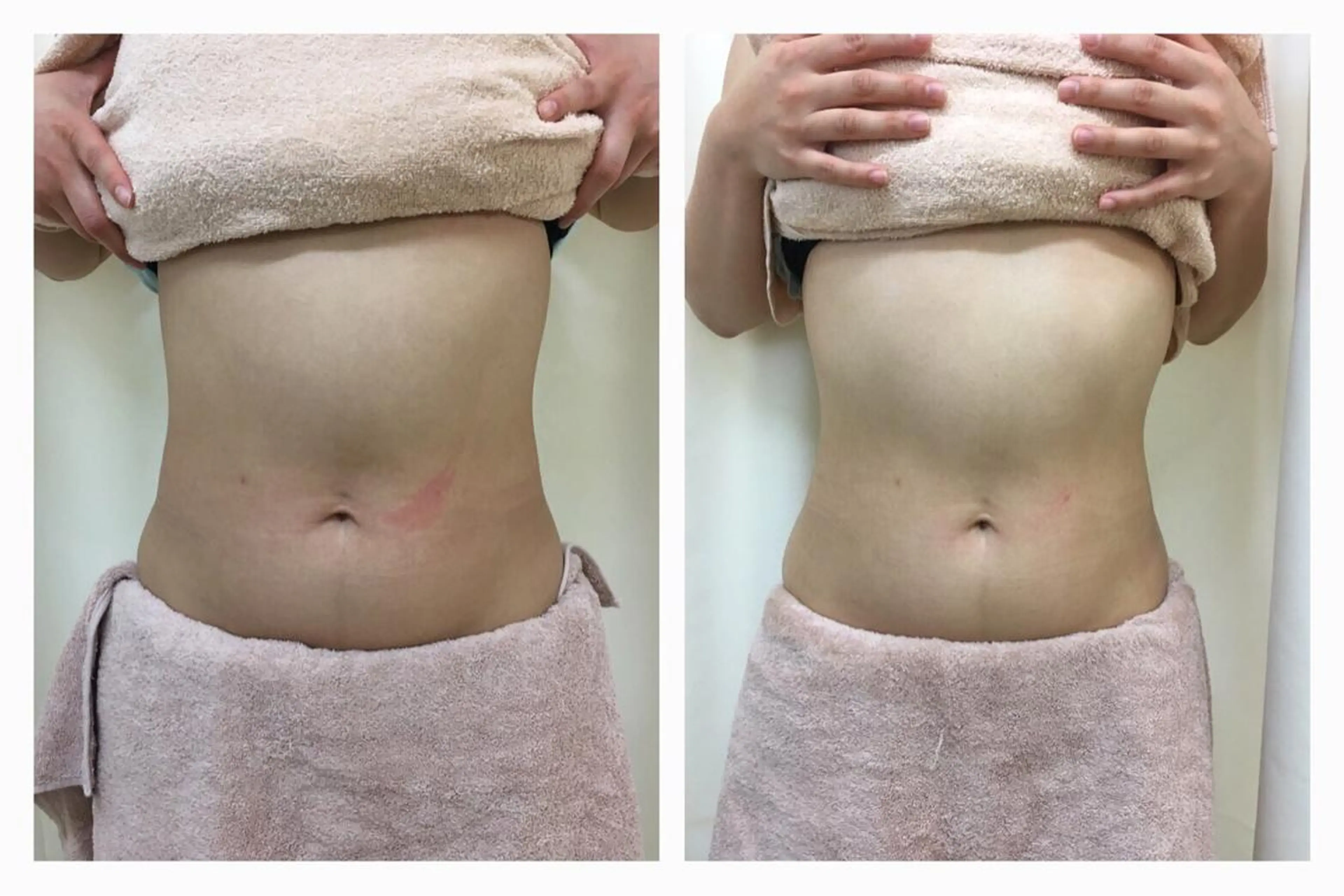 やまだ鍼灸接骨院（やまだしんきゅうせっこついん）所属・山田 晃のエステ・リラクイメージ