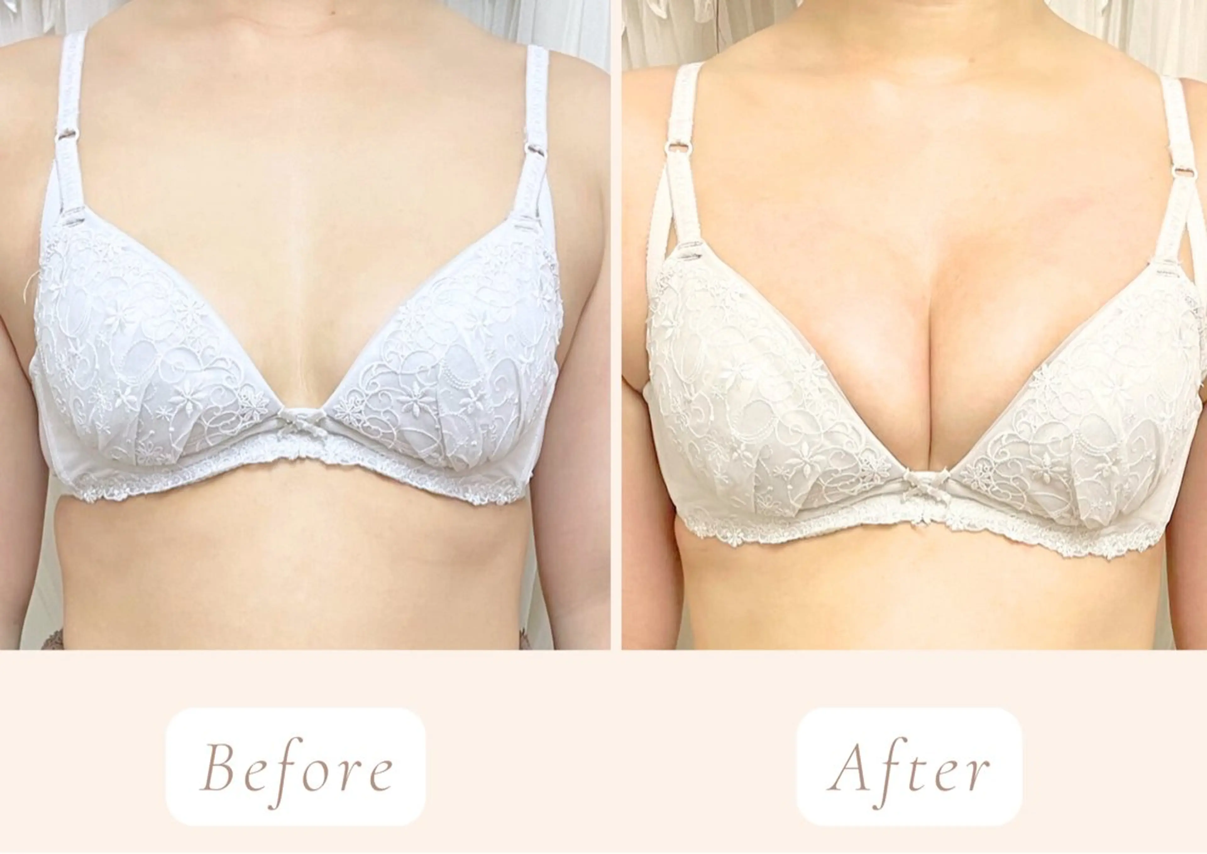 写真モニター価格【オールハンド育乳/ボリュームUP】上半身＆育乳マッサージ初回体験の写真