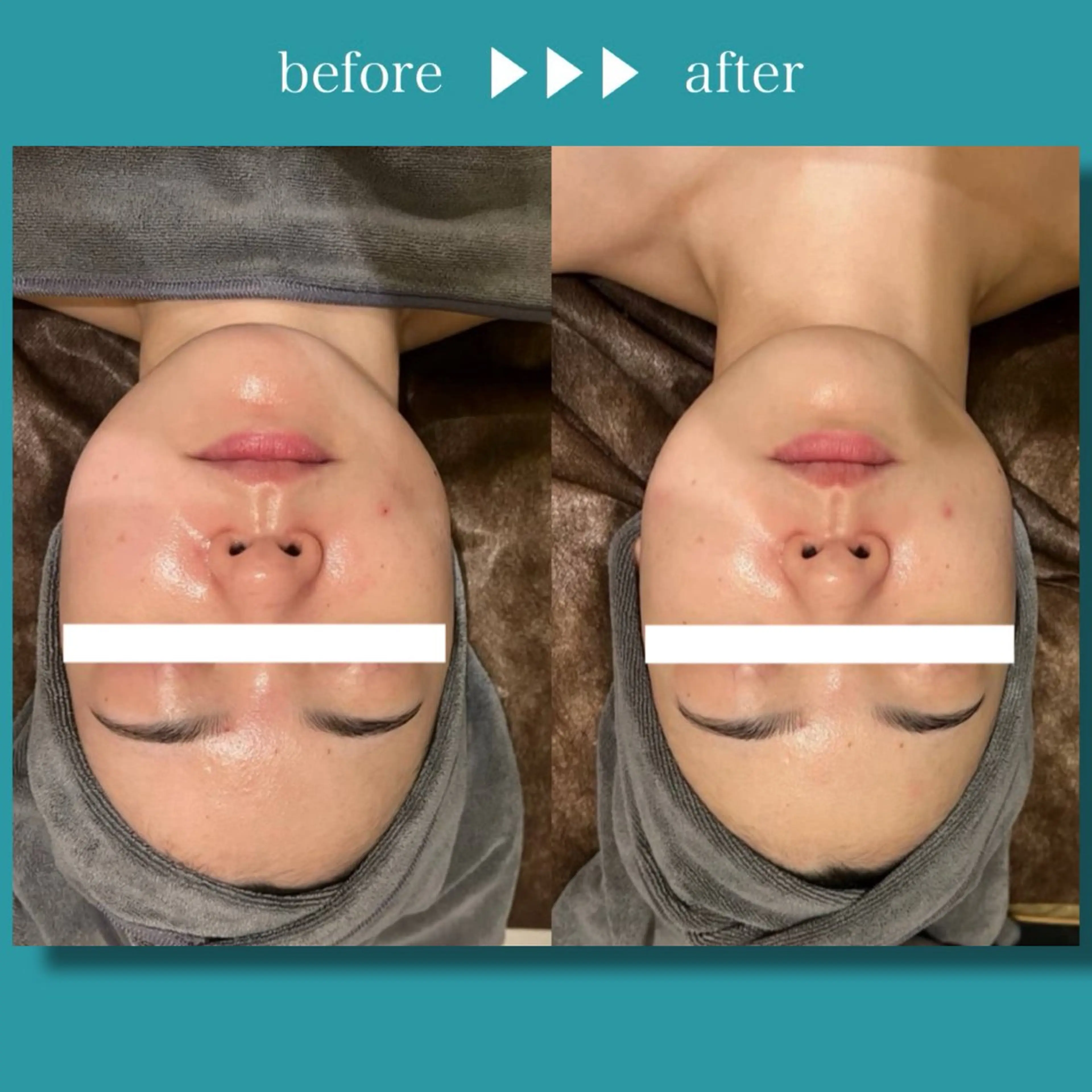 ☆痩身/小顔☆ 結果出します☆のエステ・リラクイメージ