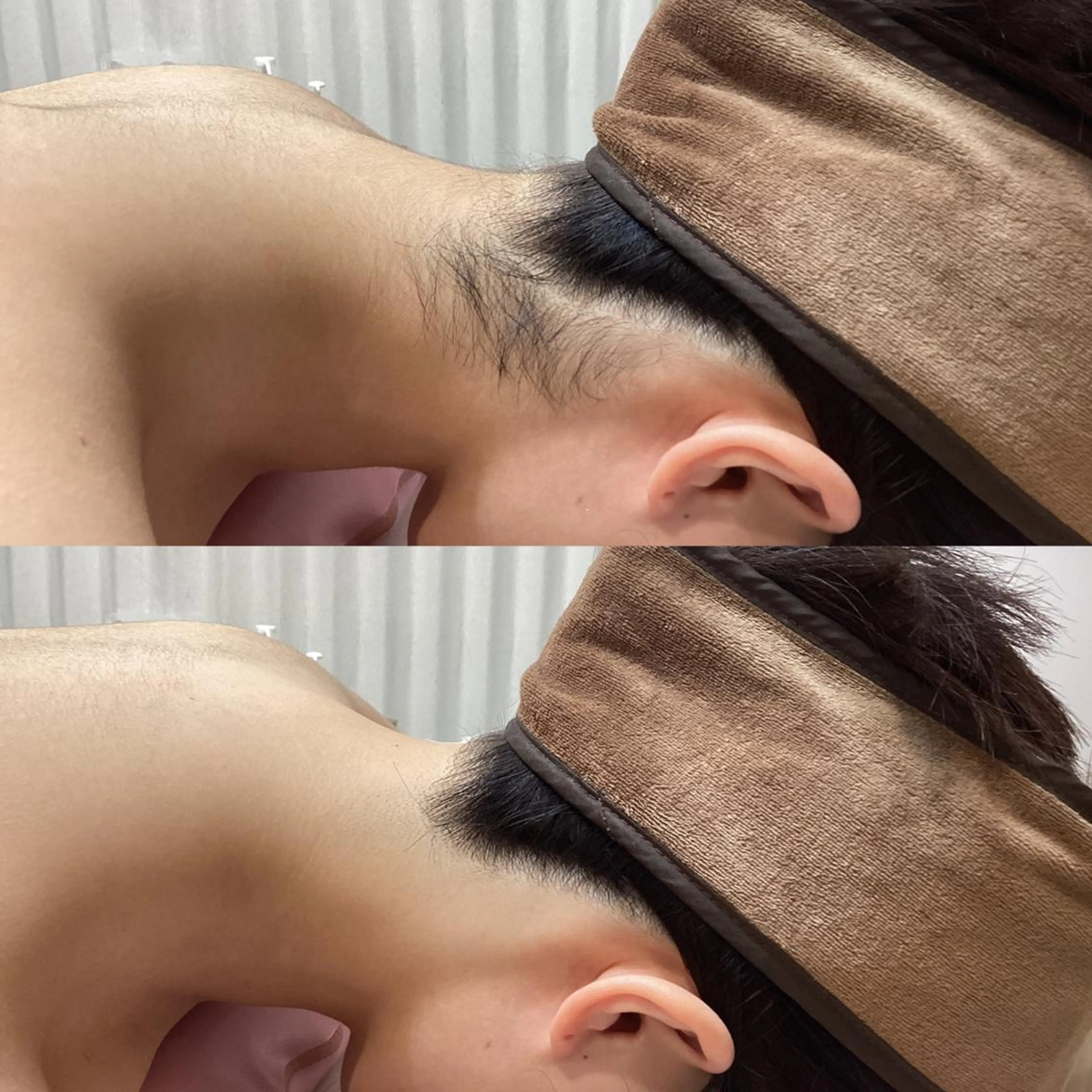 脱毛 U24💗学割エステ 💗RAYVIS池袋のエステ・リラクイメージ