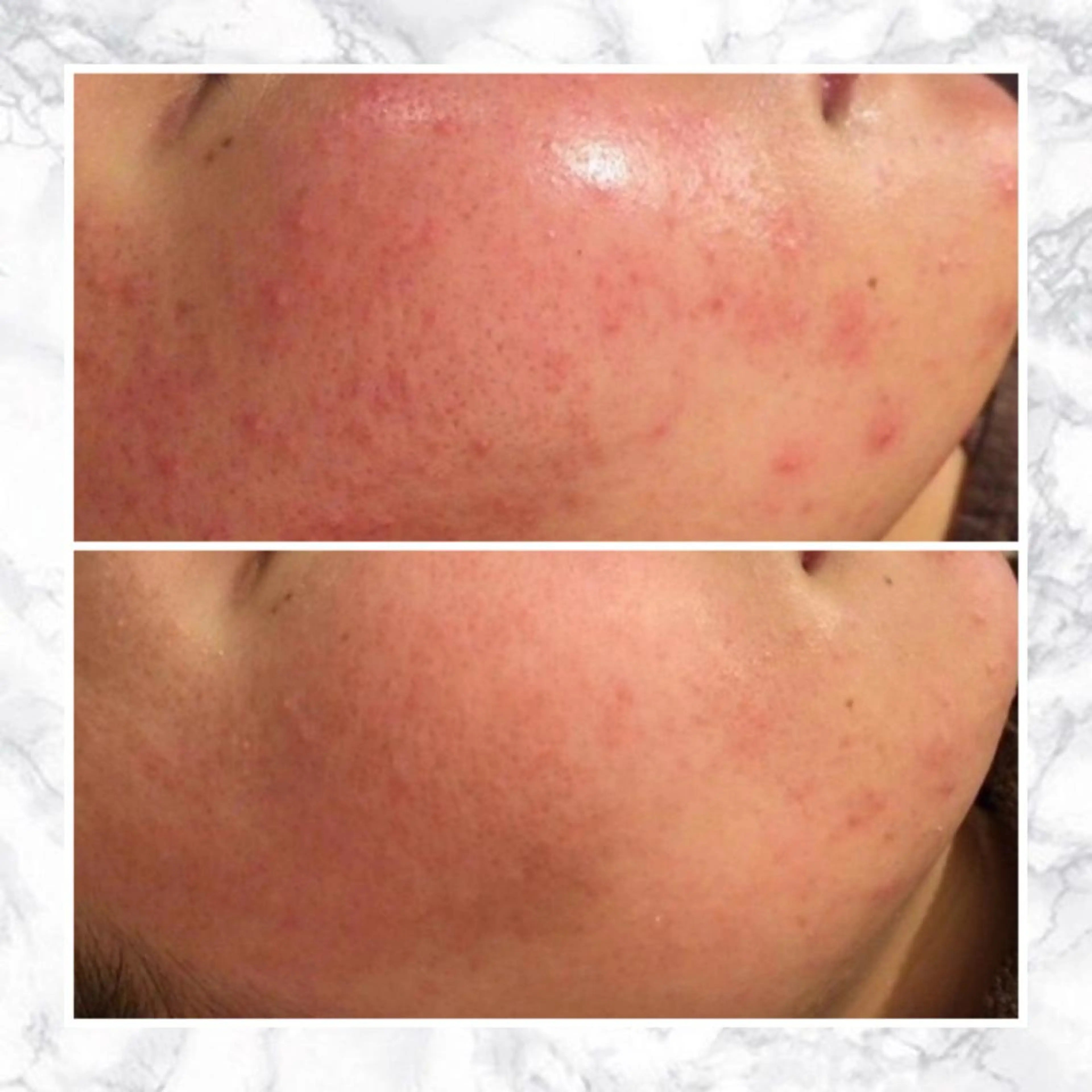 セミロング カラー パーマ ヘアアレンジ メンズ キッズ ネイル マツエク・マツパ アイブロウ 触れたくなる モテ肌へ...❤︎のエステ・リラクイメージ