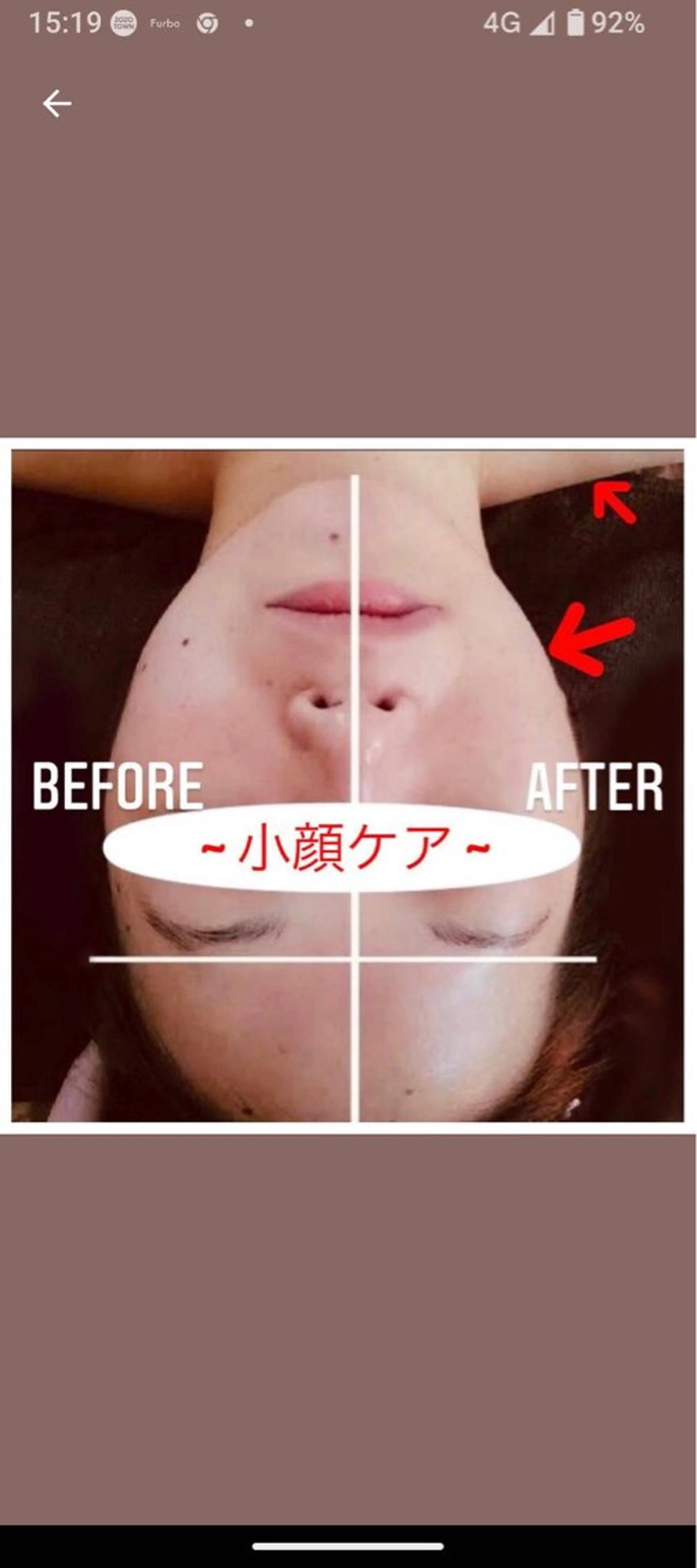 ✨️20才​〜​27才の女性限定👸美顔器を使用した小顔ケア♡表情筋を動かしムクミ‼️毒素‼️を流していきます🌈の写真