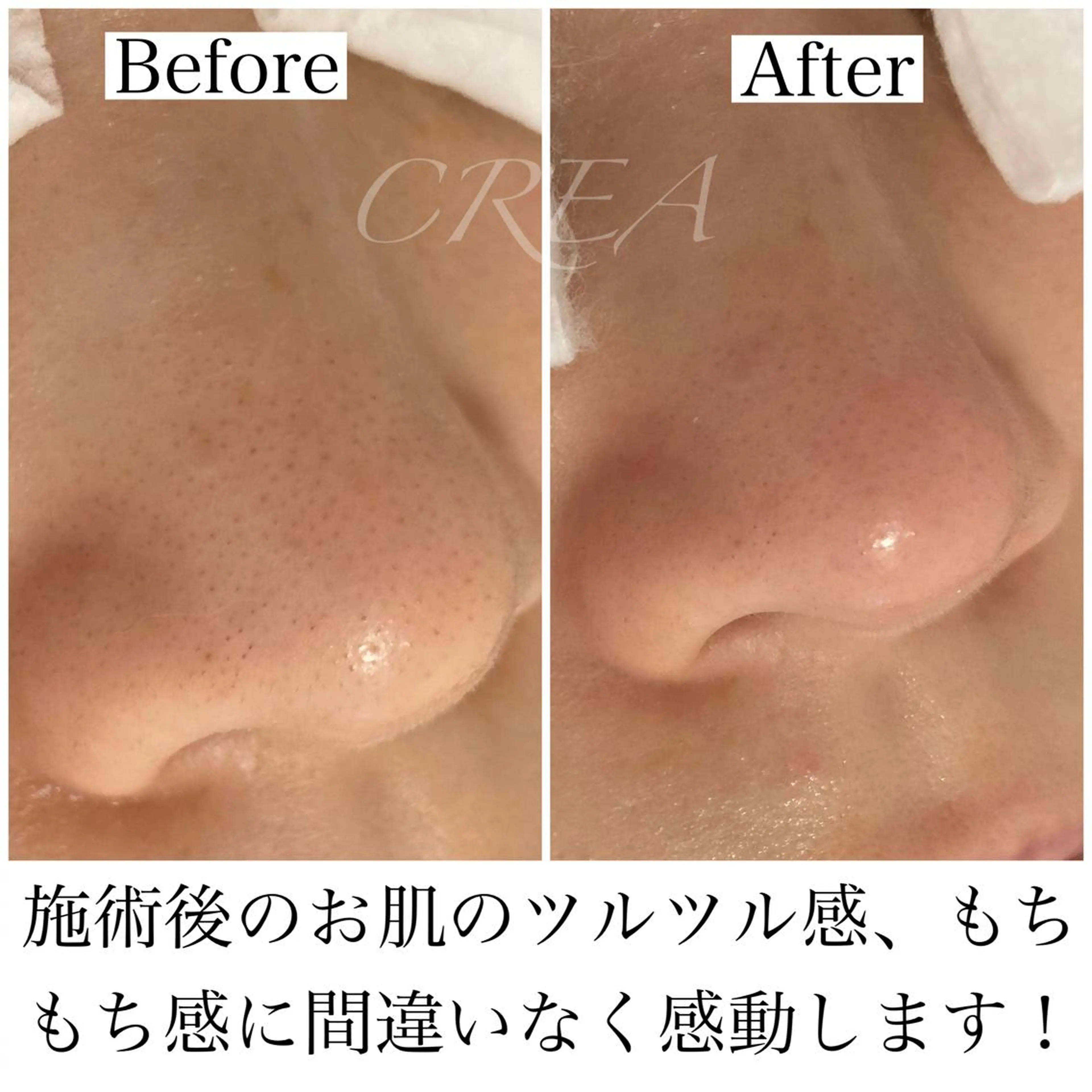 CREA【クレア】 川中のエステ・リラクイメージ