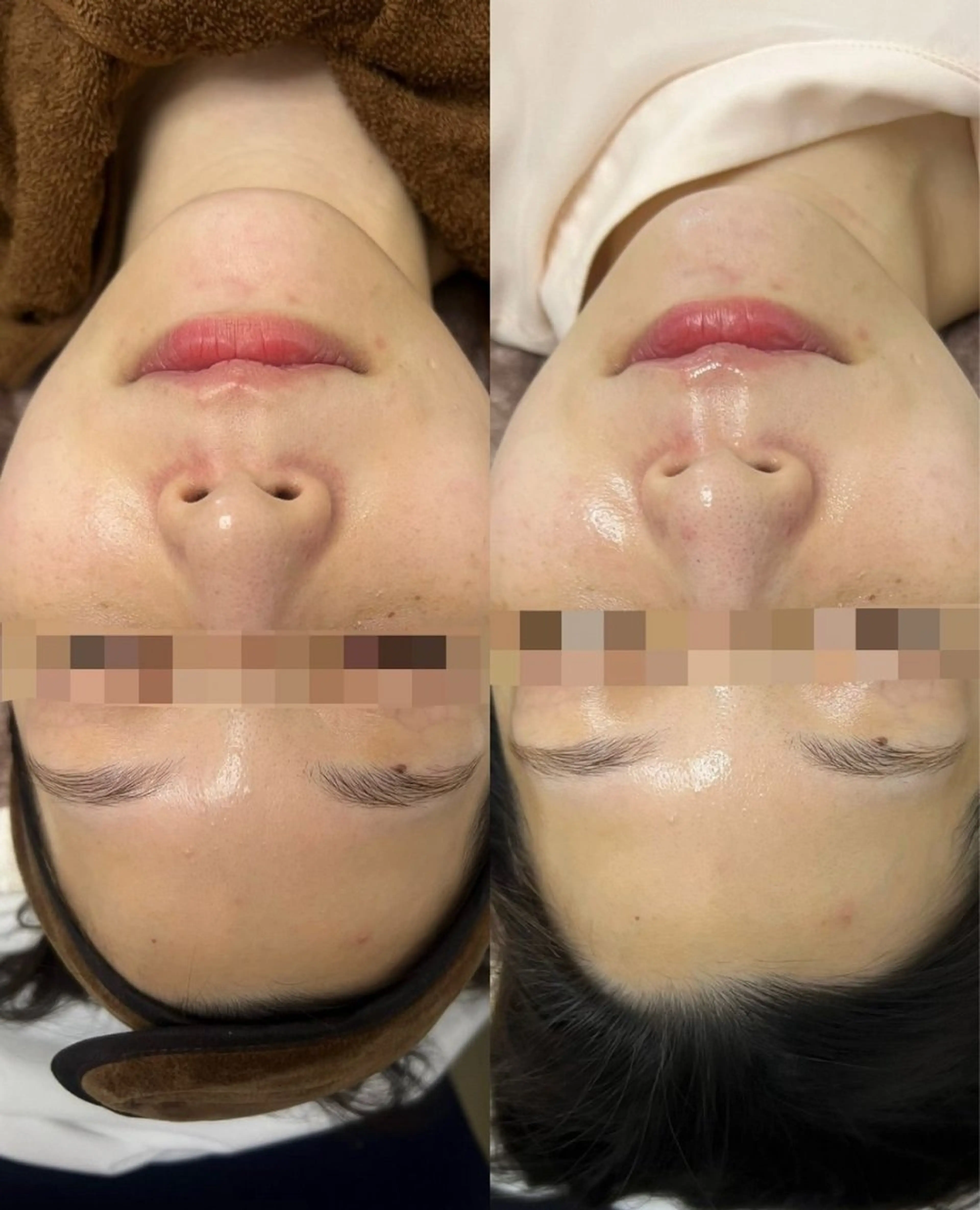 エステ 看護師が施術する ナスサロ/Emi🪽のエステ・リラクイメージ