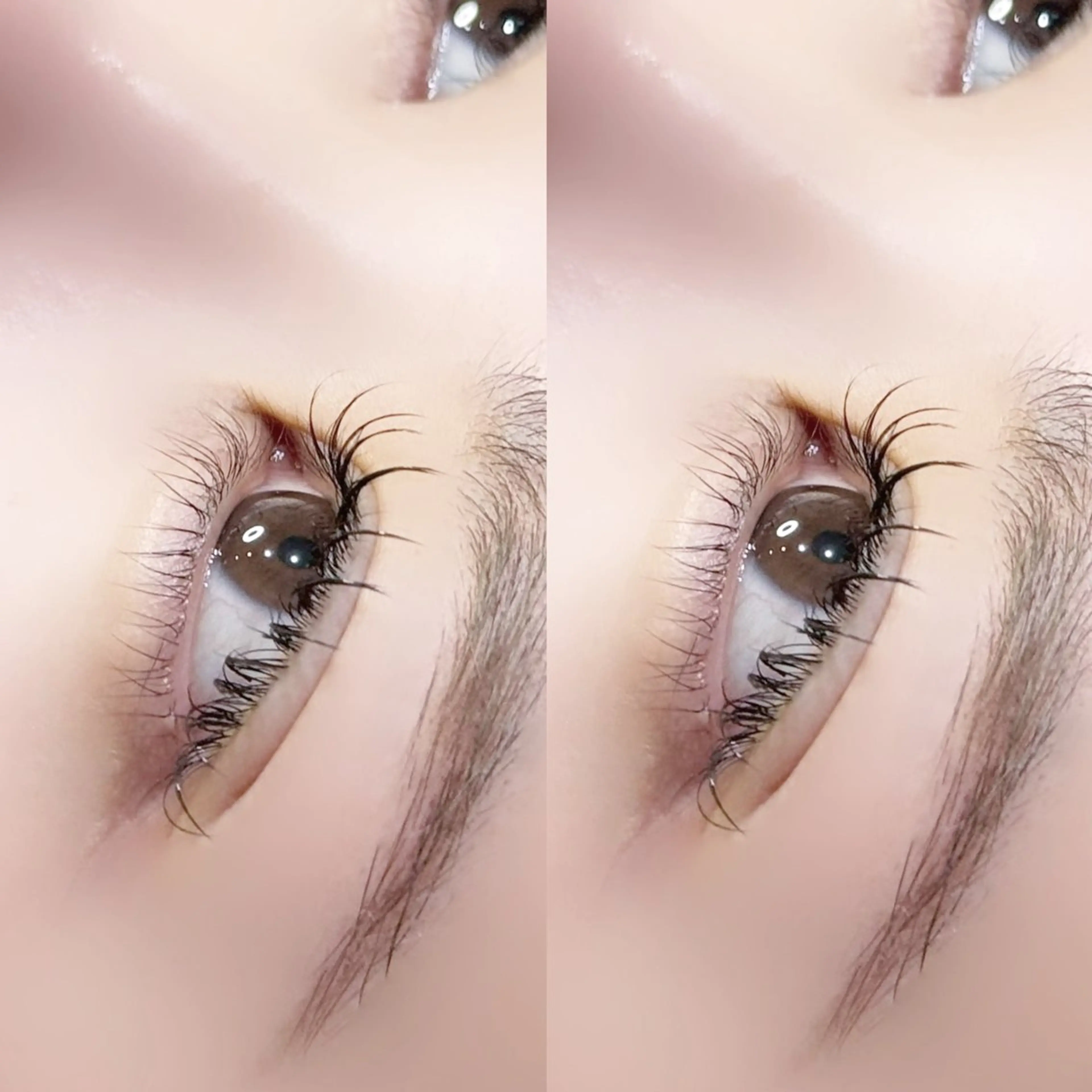 フラットラッシュ 100本の写真