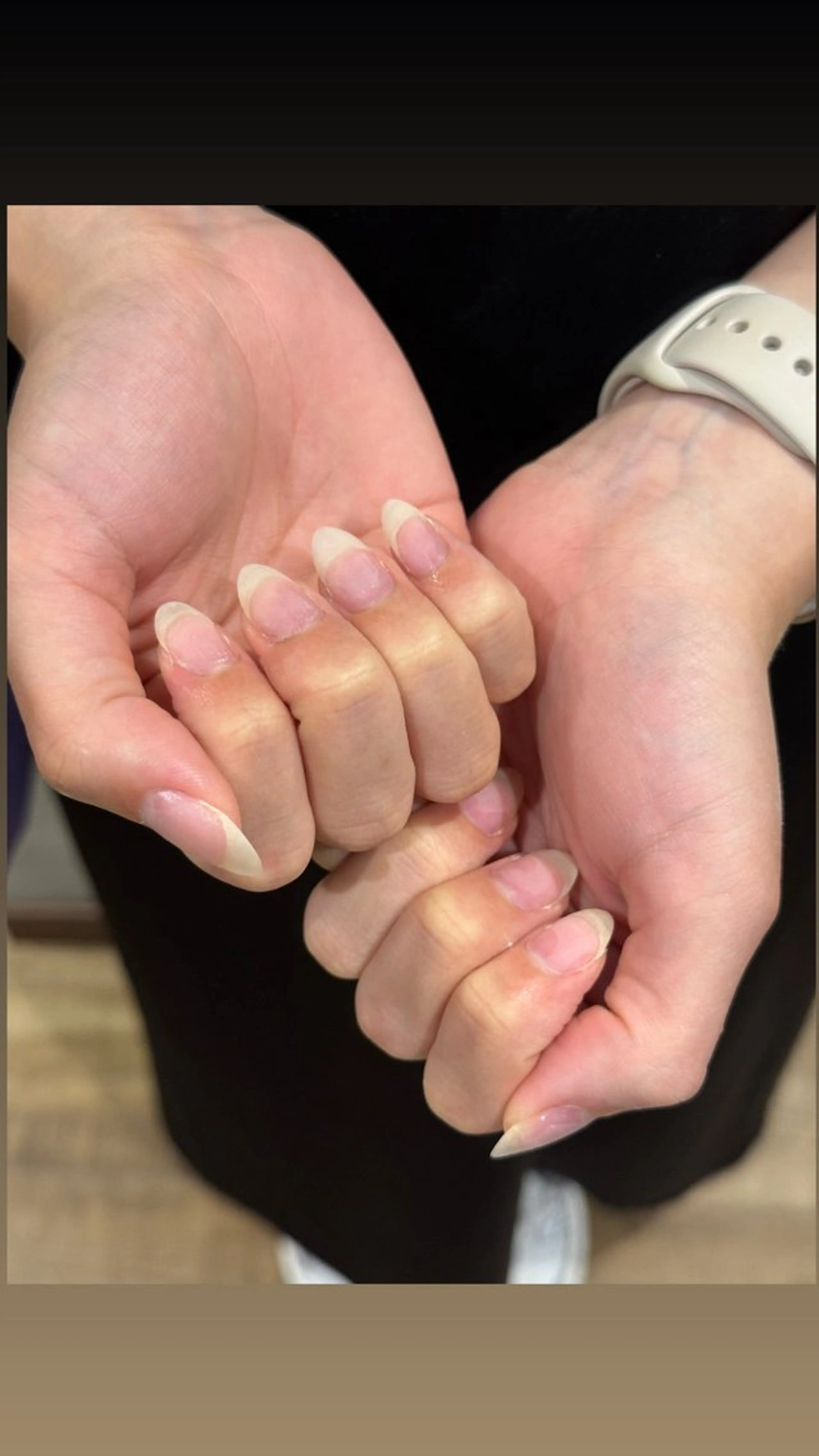 ソフトジェルオフのみ（ハンド）の写真