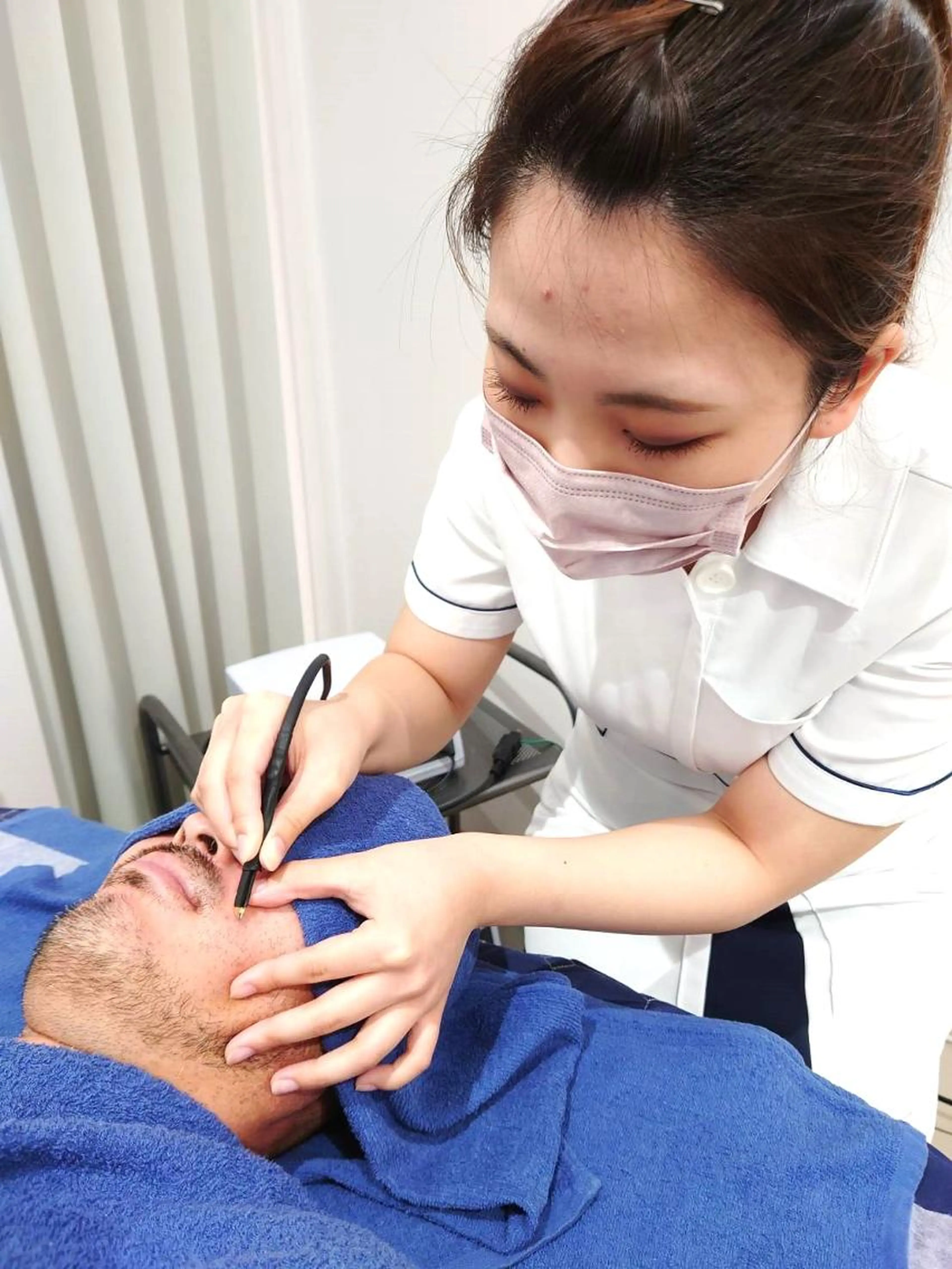 【メンズ脱毛】ピンポイント1本処理の1回完了脱毛/1本¥200×20本¥4000→¥999の写真