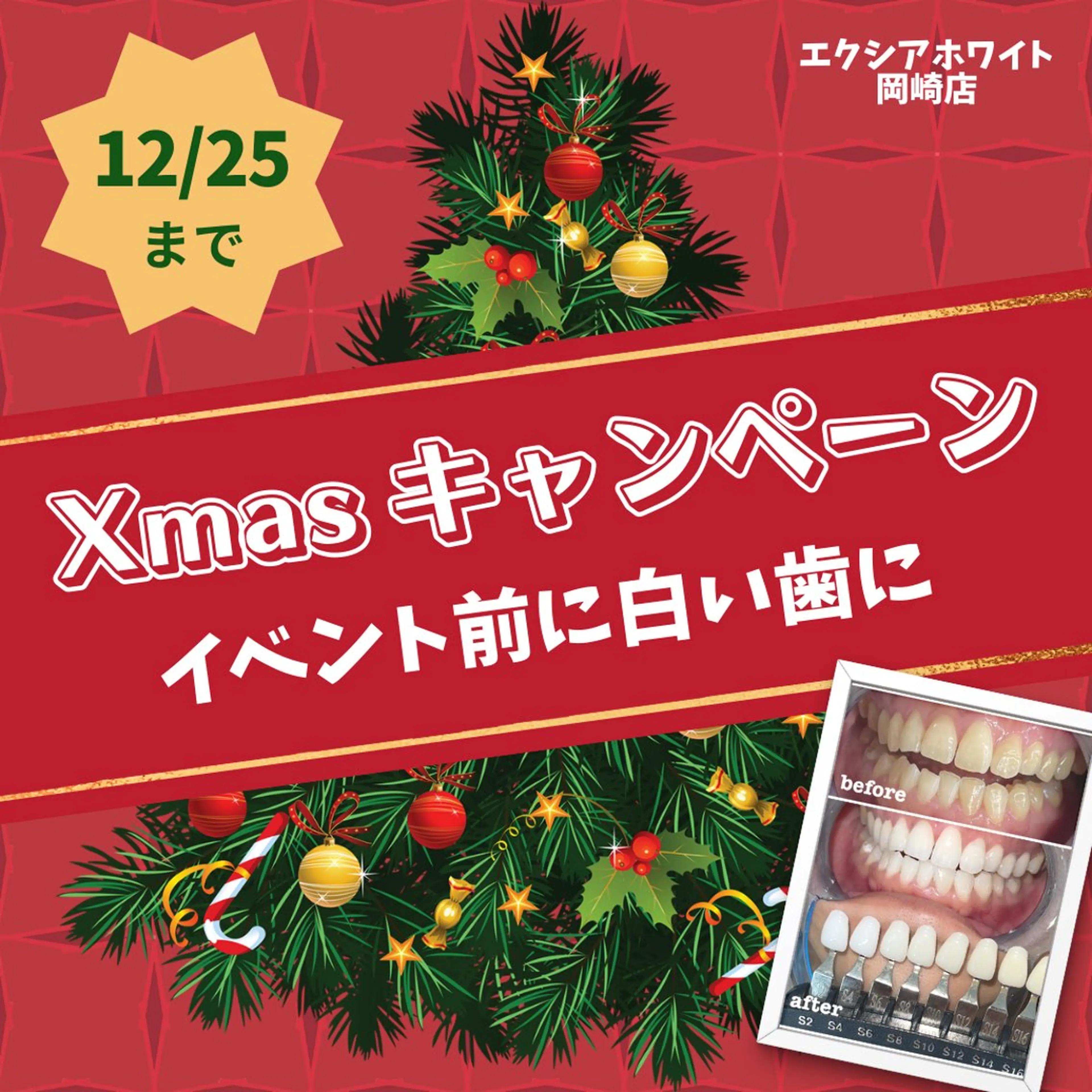 先着10名様(残り9名)🖤クリスマス限定/通常初回⇒40%off✨️9分×2セットお試しホワイトニング🦷✨️の写真
