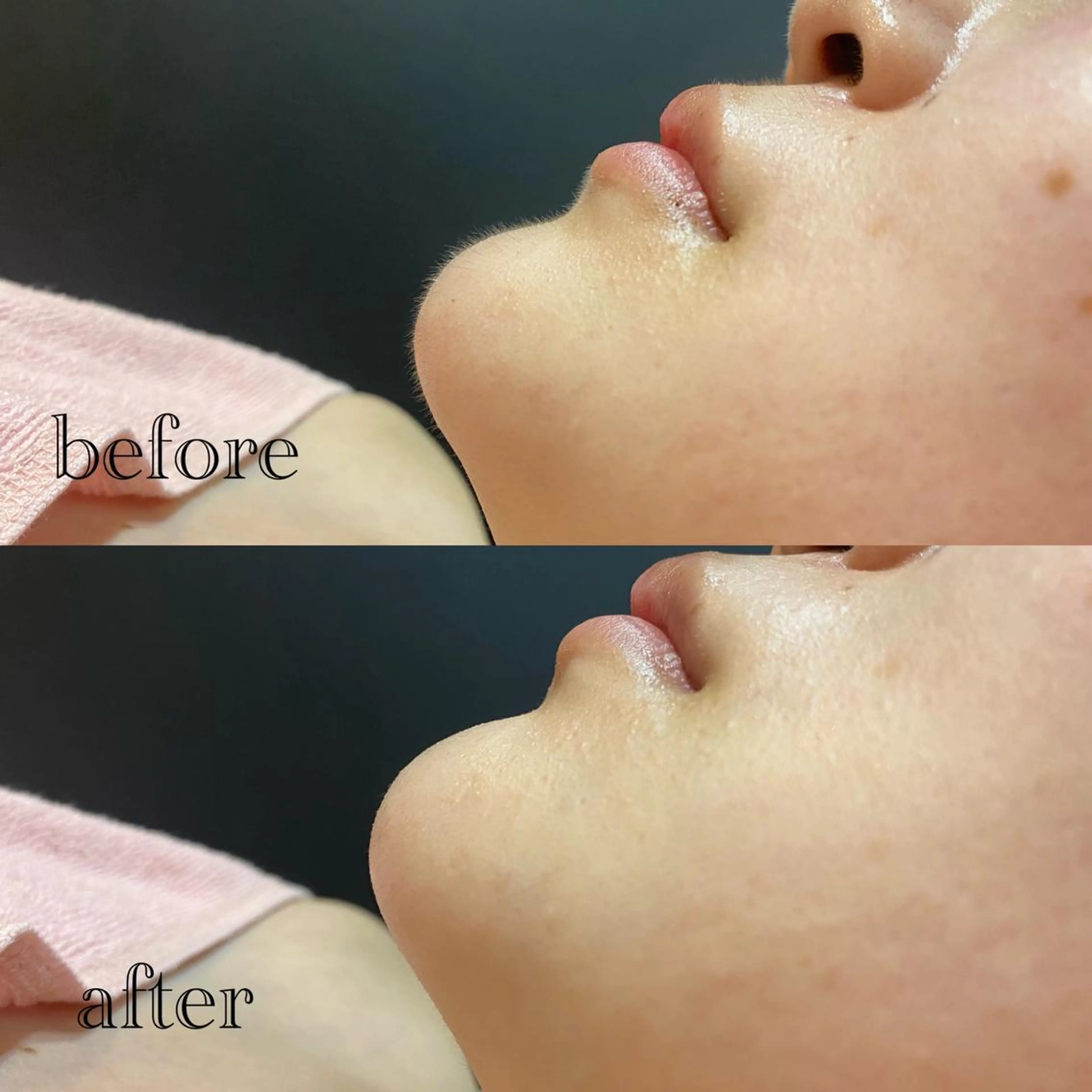 🫧美しい素肌へ🫧 今成柚乃のその他イメージ