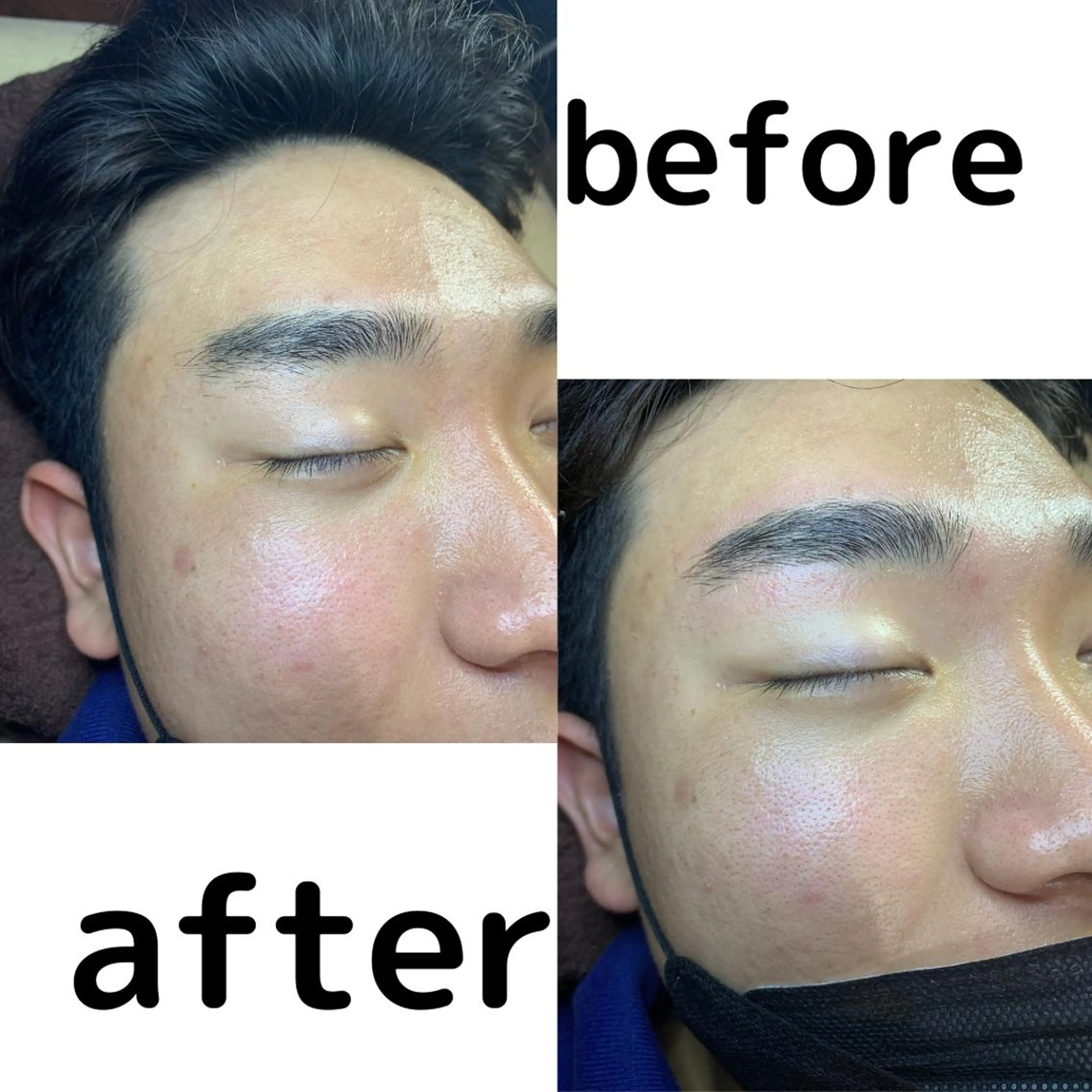 メンズ 20代から始める脱毛 salonLEPIAのエステ・リラクイメージ