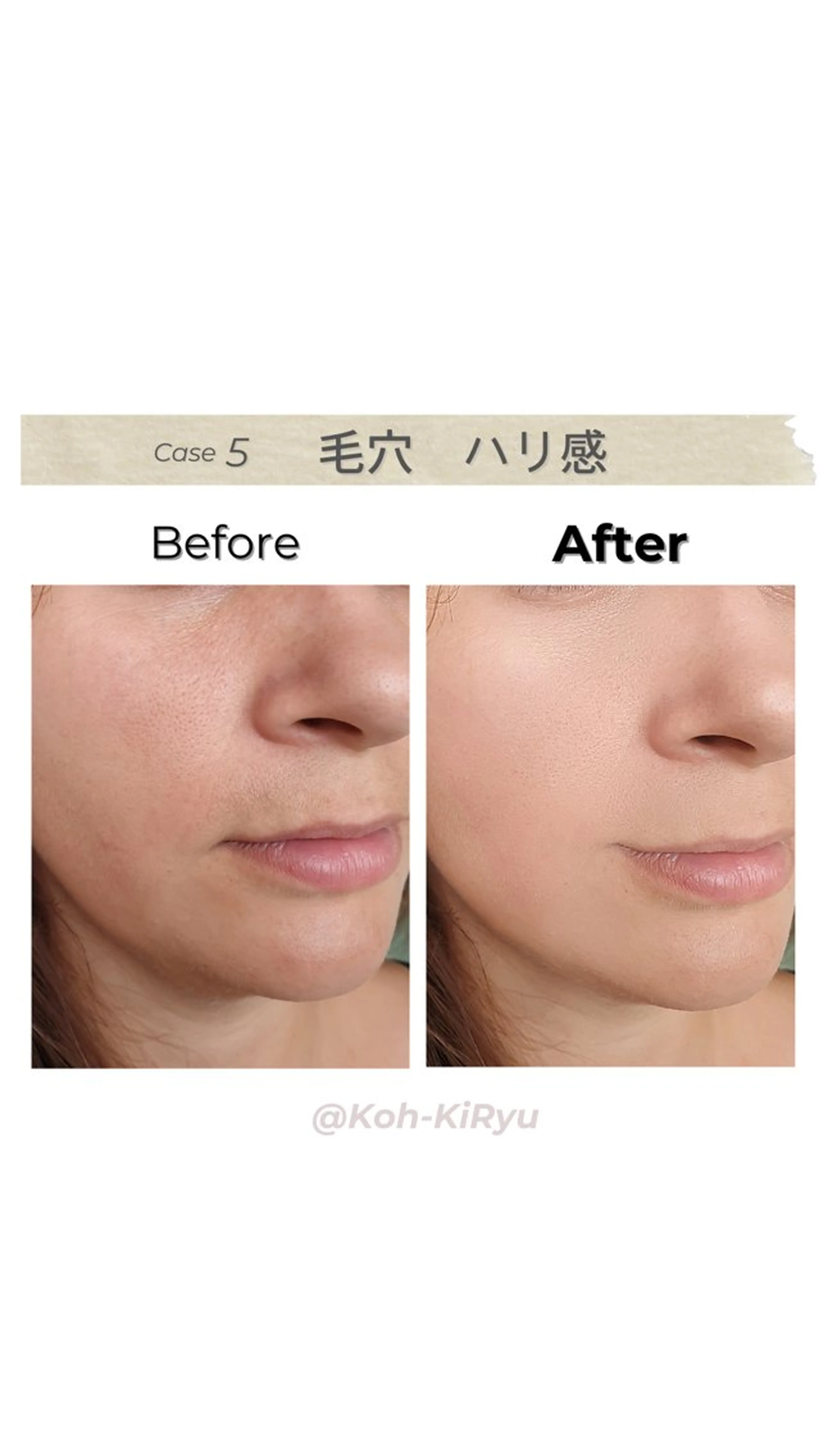 エステ ハーブ蒸しサロン🌿 香嬉琉🌿きよかのエステ・リラクイメージ