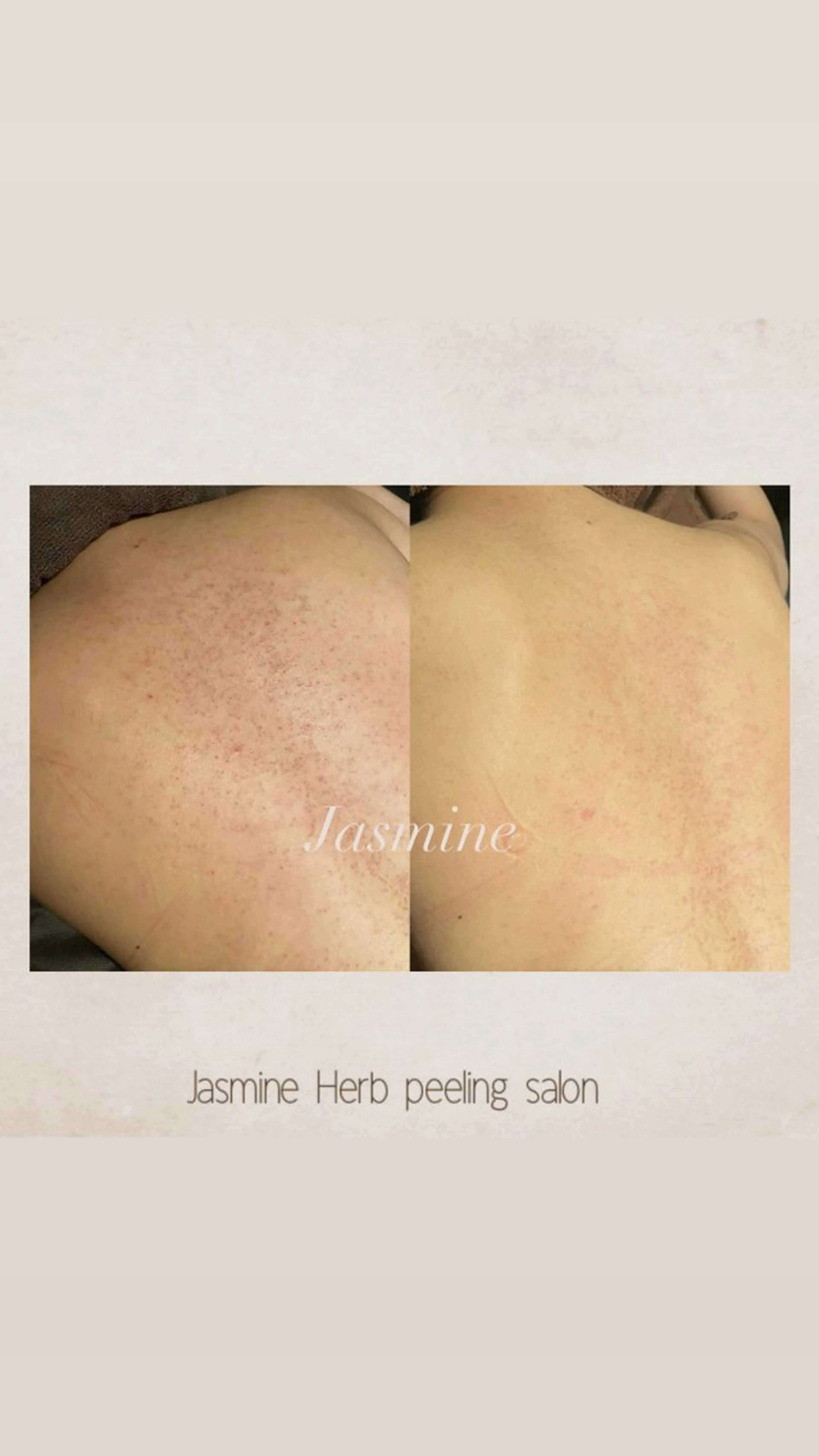 エステ Jasmine所属・Jasmine herbのエステ・リラクイメージ