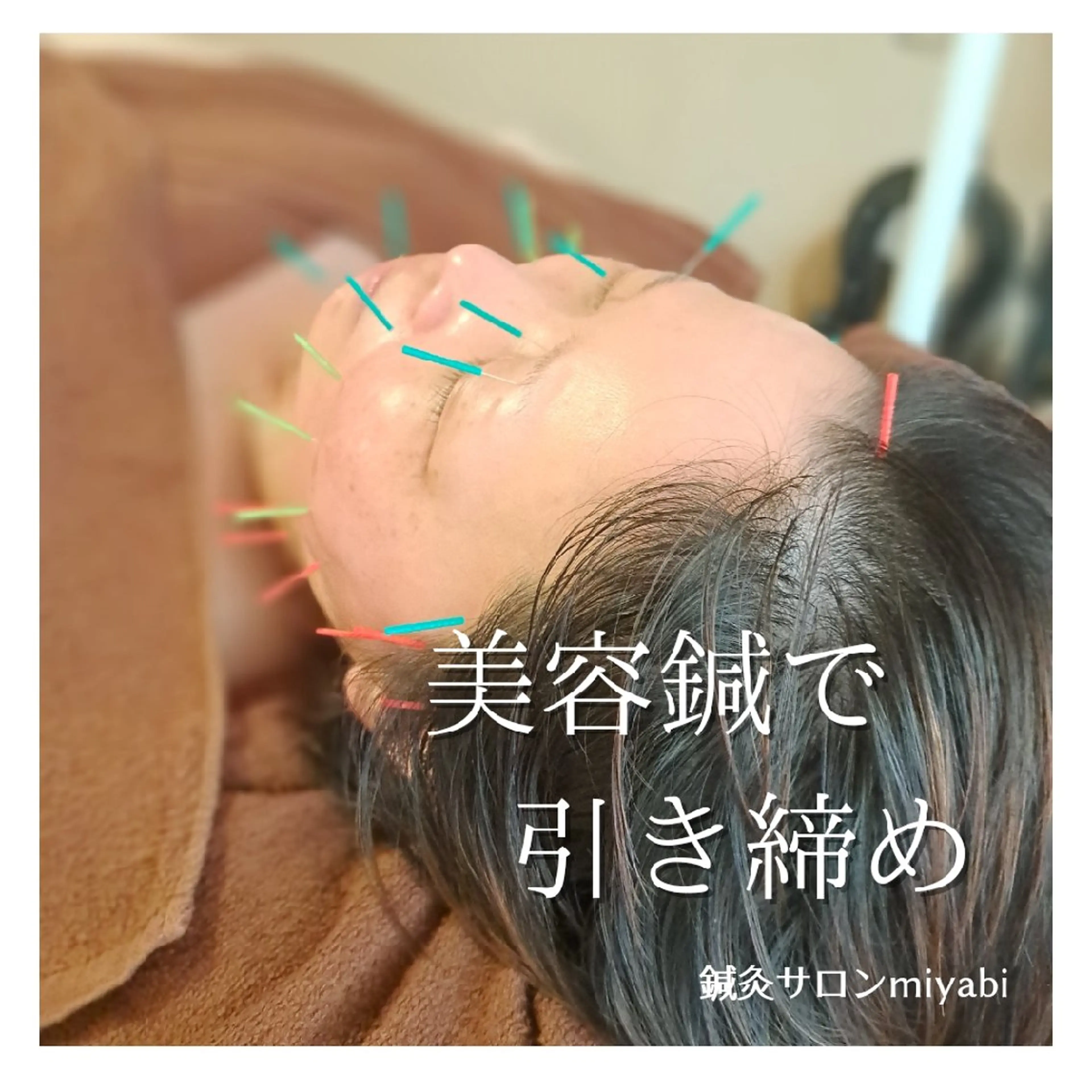 エステ リラク 鍼灸サロンmiyabi所属・美容鍼×エステ　鍼灸 サロンmiyabiのエステ・リラクイメージ