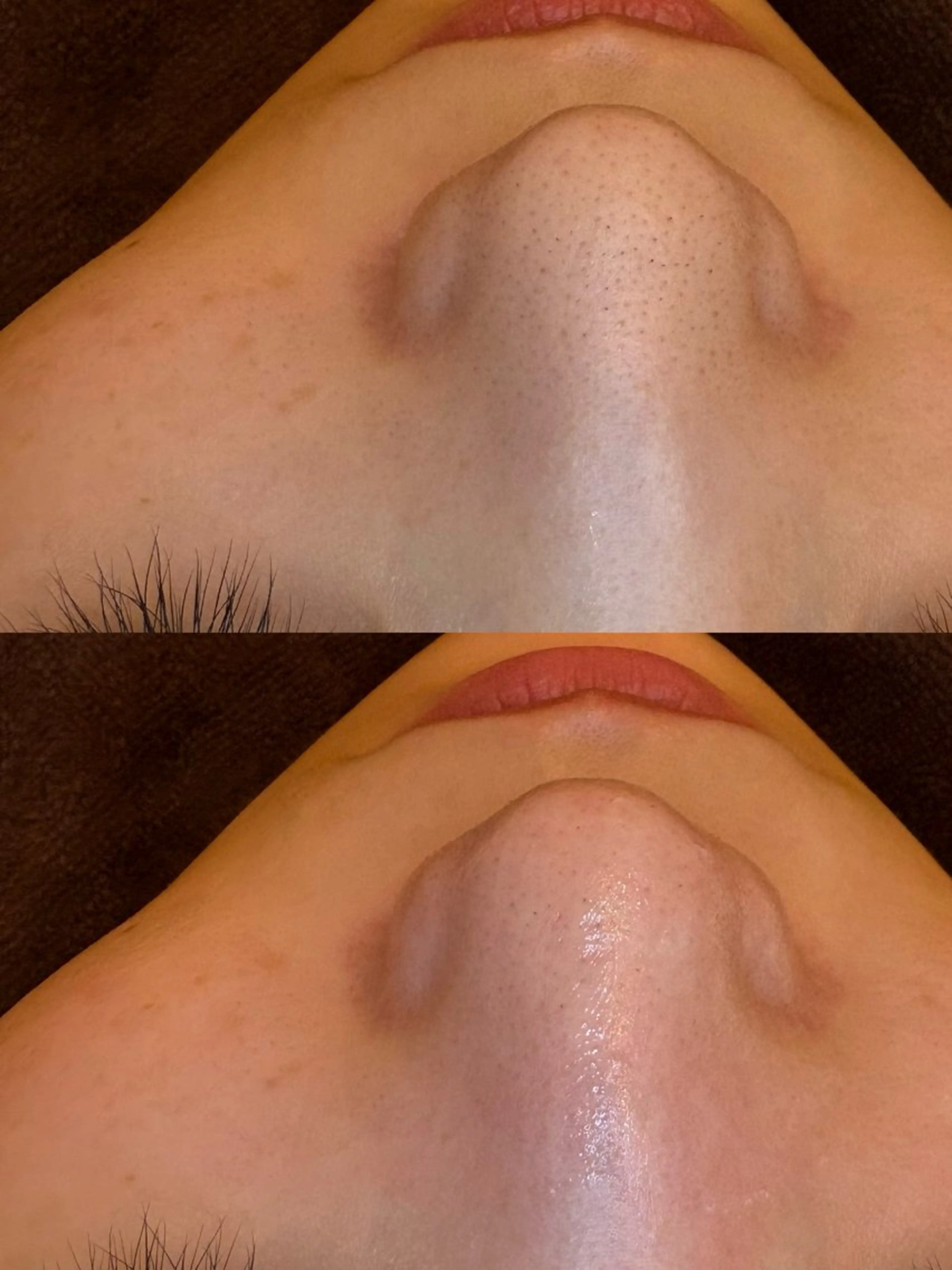 エステ EARTH coiffure beaute 新潟紫竹山店所属・🤍アベシュリ /フェイシャル🤍のエステ・リラクイメージ