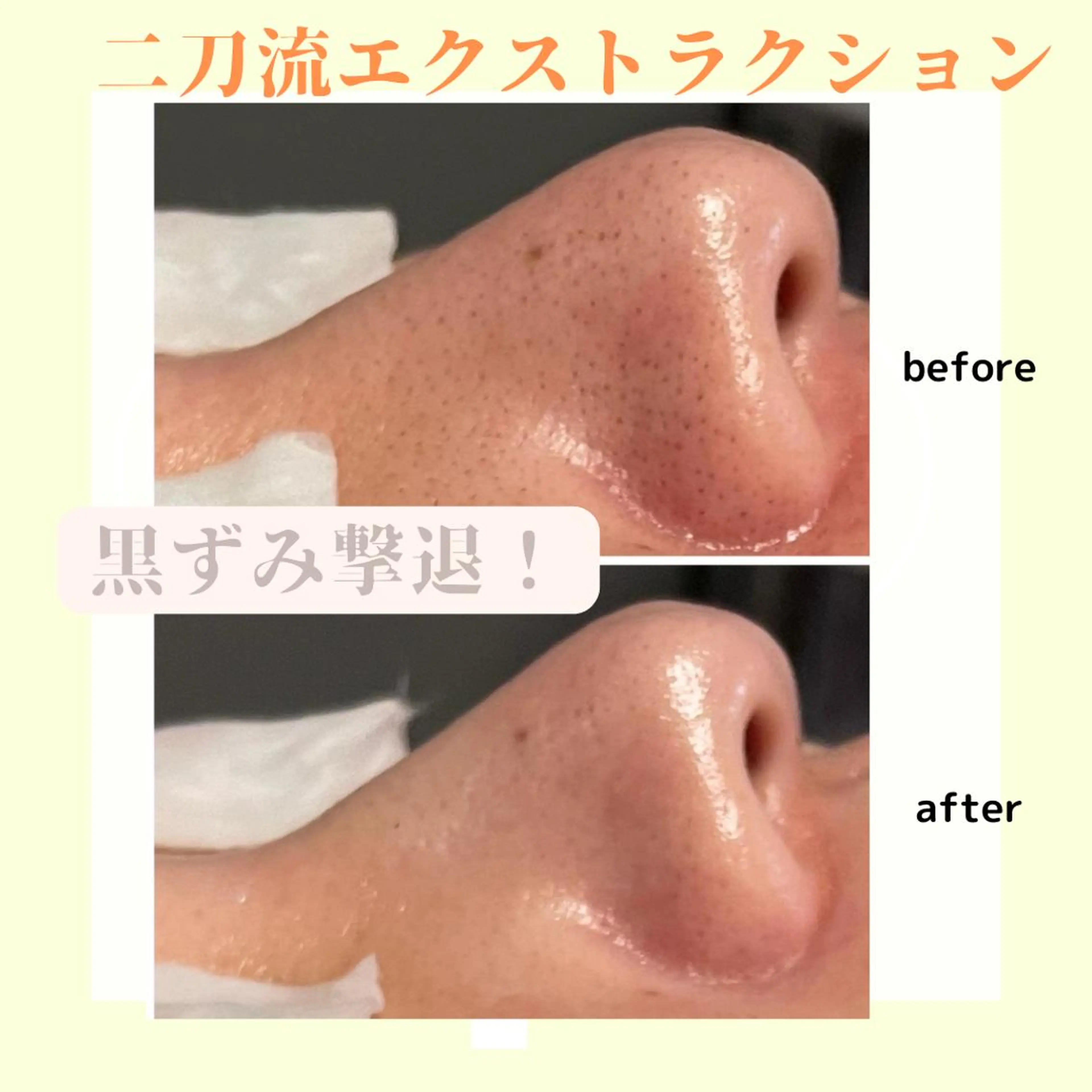 エステ リラク ピーリング専門店 Belluteのエステ・リラクイメージ