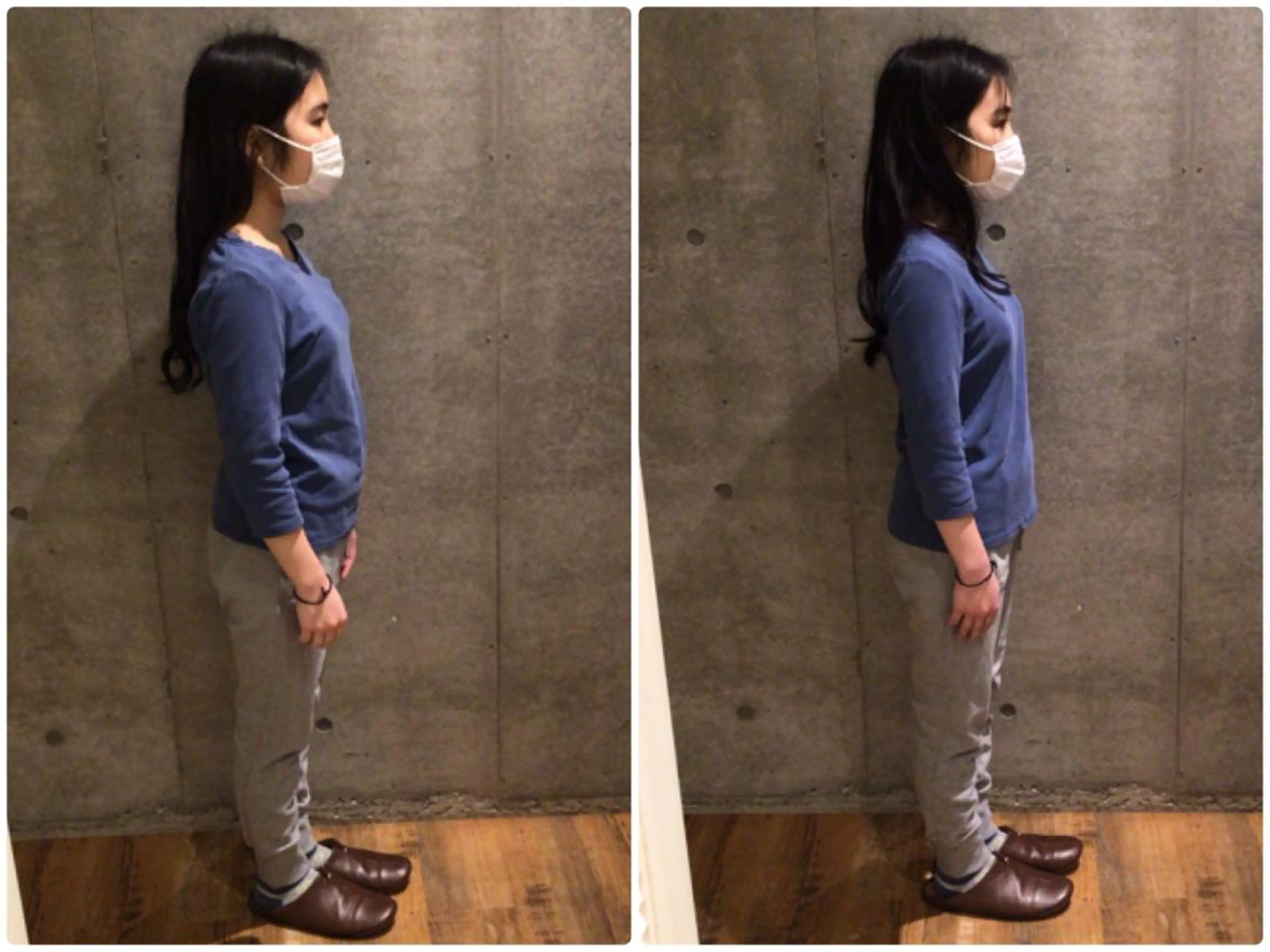 目黒/小顔/骨盤/ 美容鍼/美顔鍼/小林のエステ・リラクイメージ