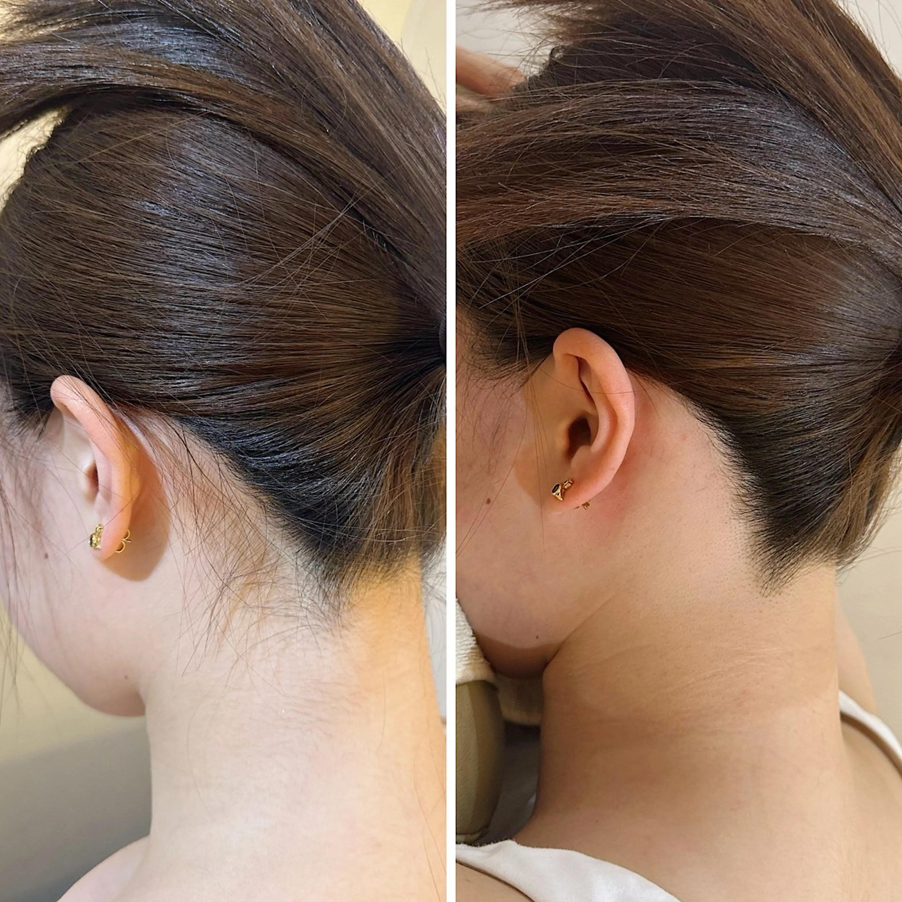 脱毛 うなじ脱毛/美肌脱毛 LABELのエステ・リラクイメージ