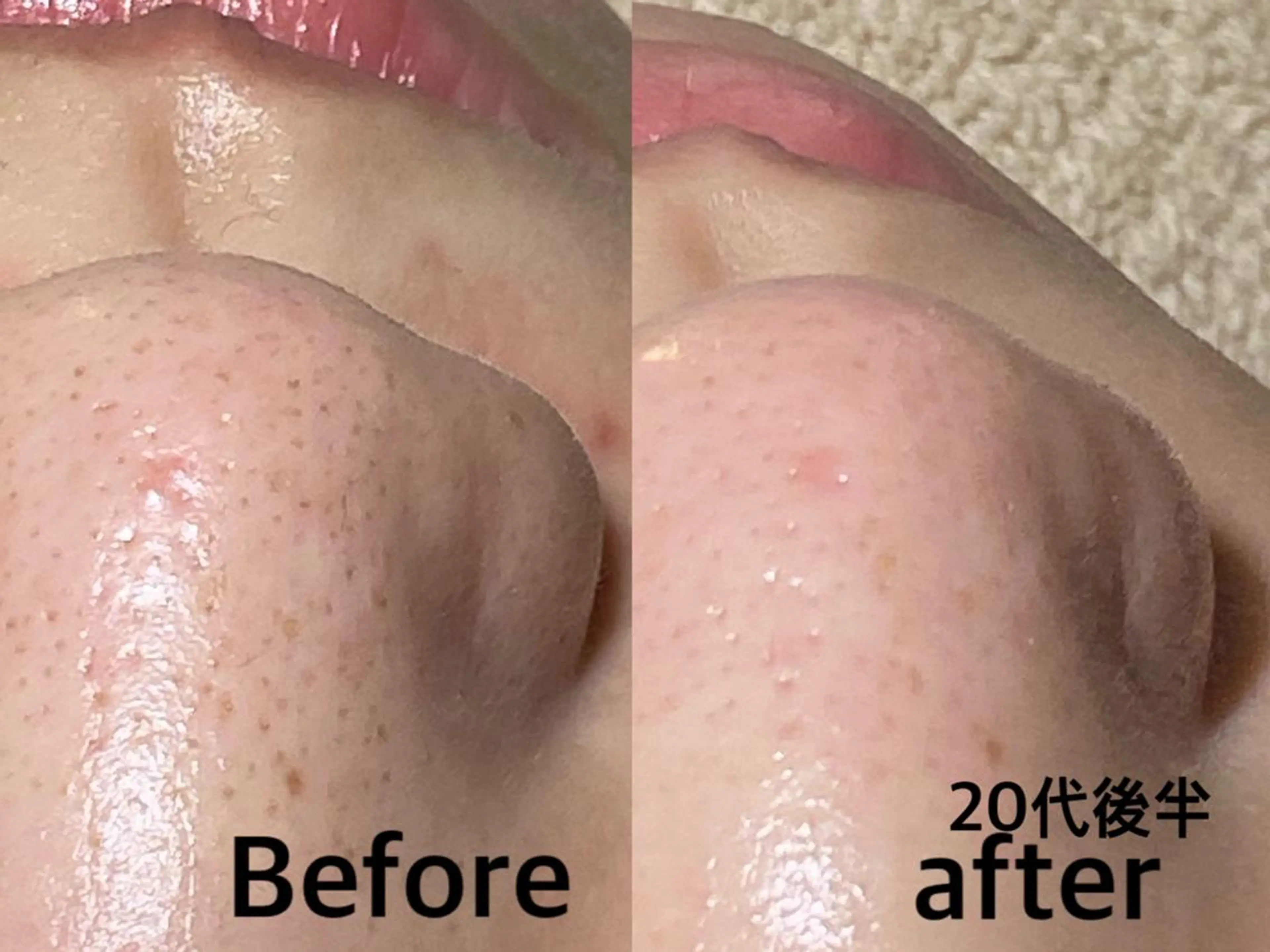 エステ NICOLAUGH/ 村松【小顔.ボディ】のエステ・リラクイメージ