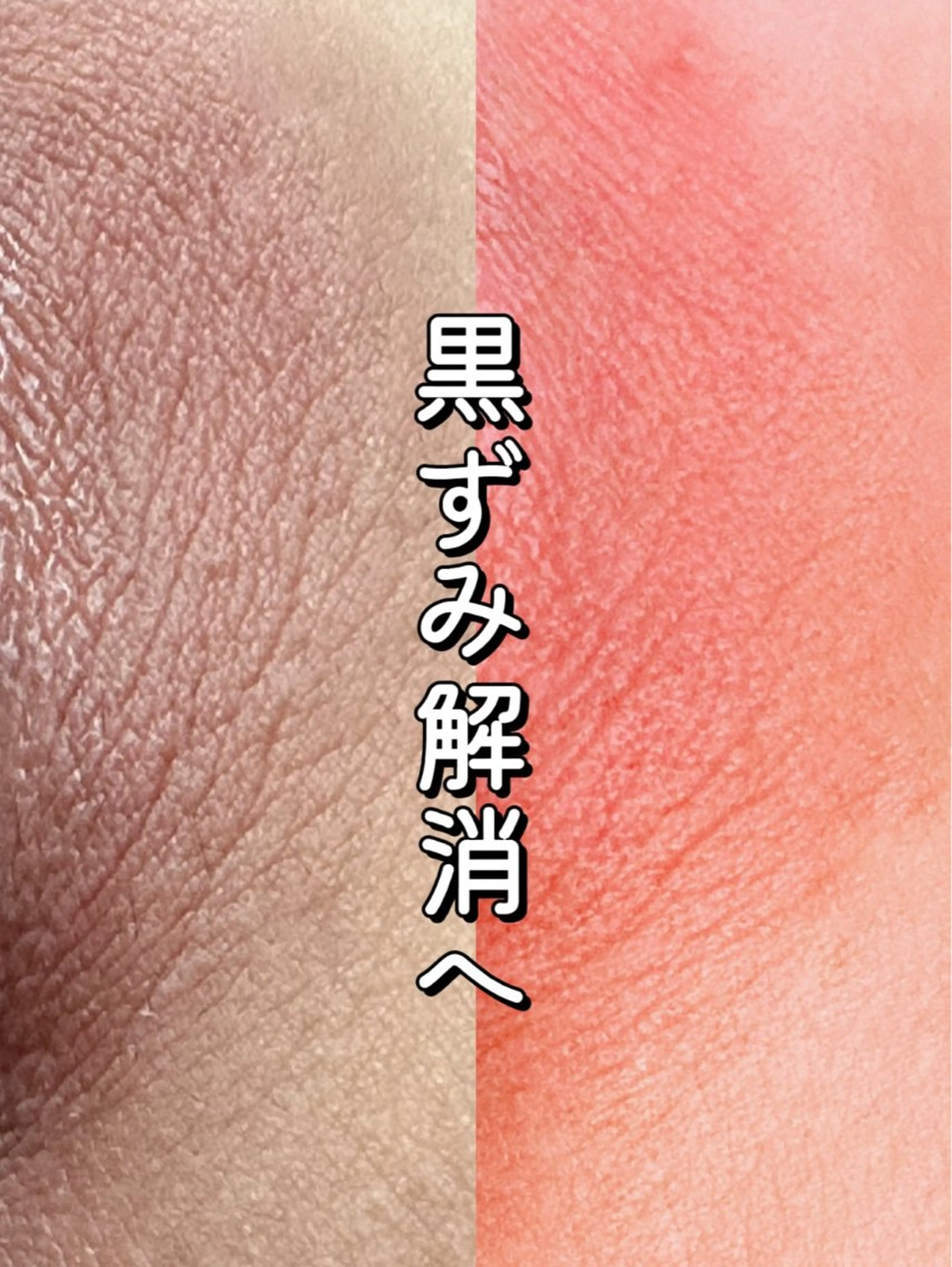 Hit. シュガーリング豊橋のエステ・リラクイメージ