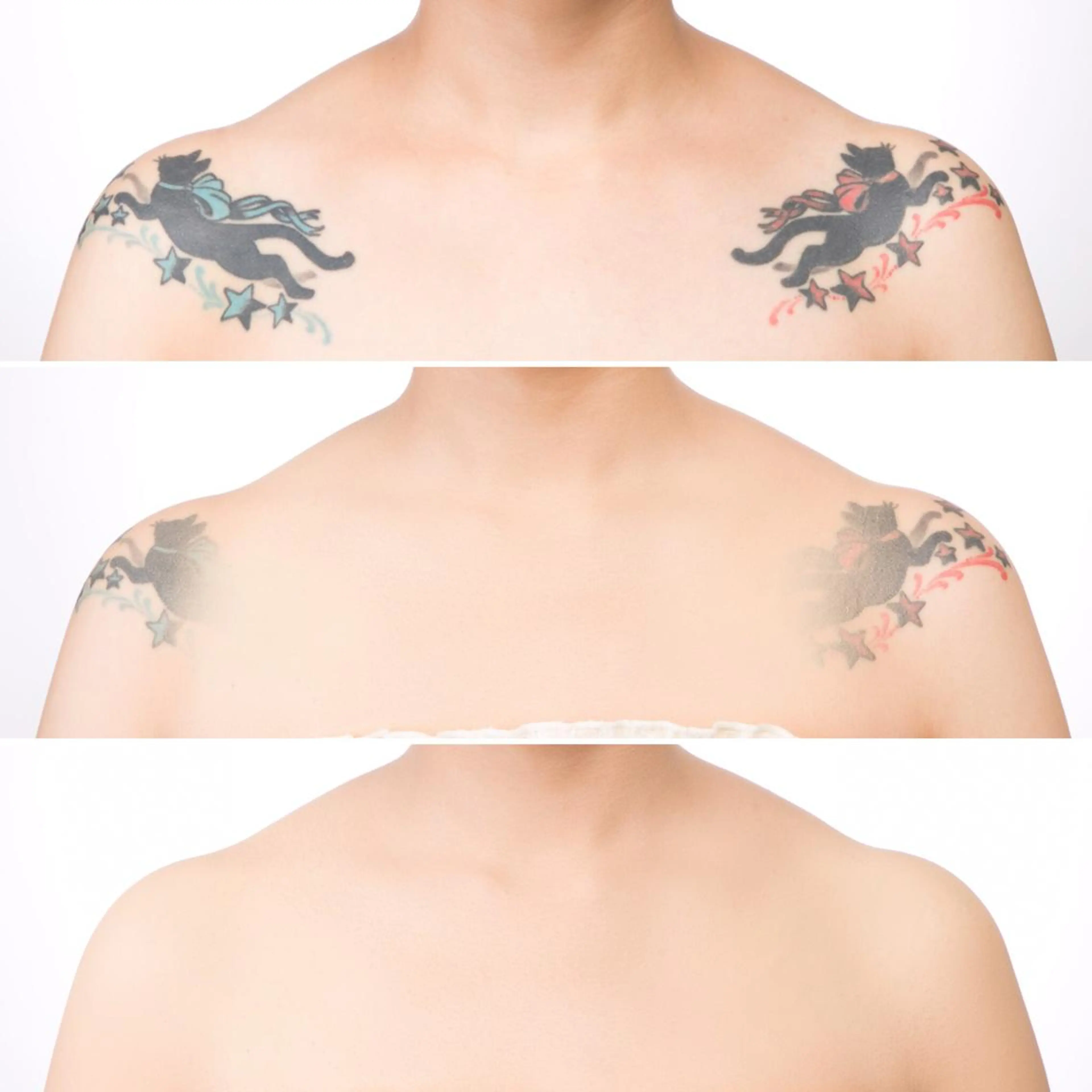 タトゥカバーモデルの写真