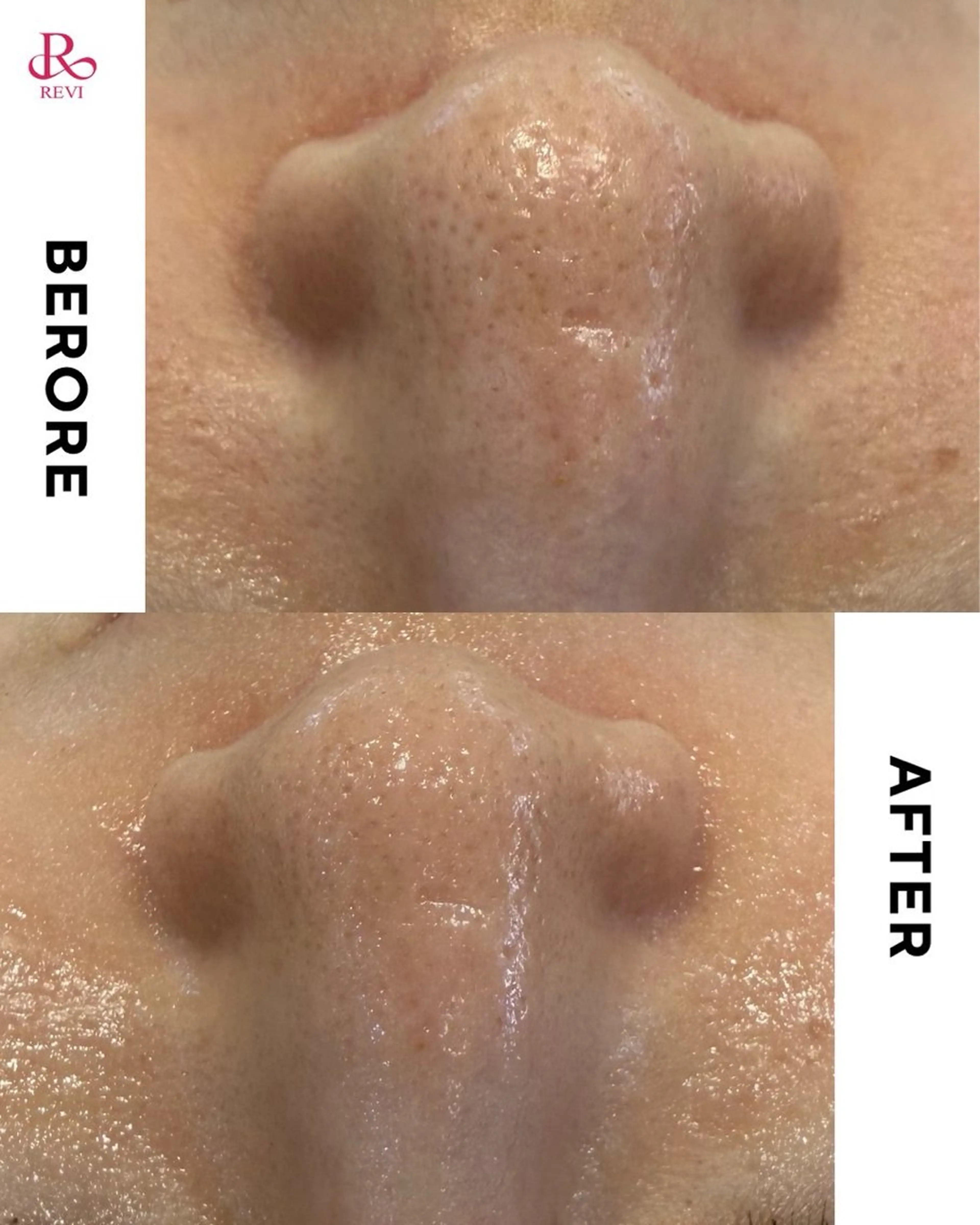 エステ skinity所属・ピーリング専門サロン skinityのエステ・リラクイメージ