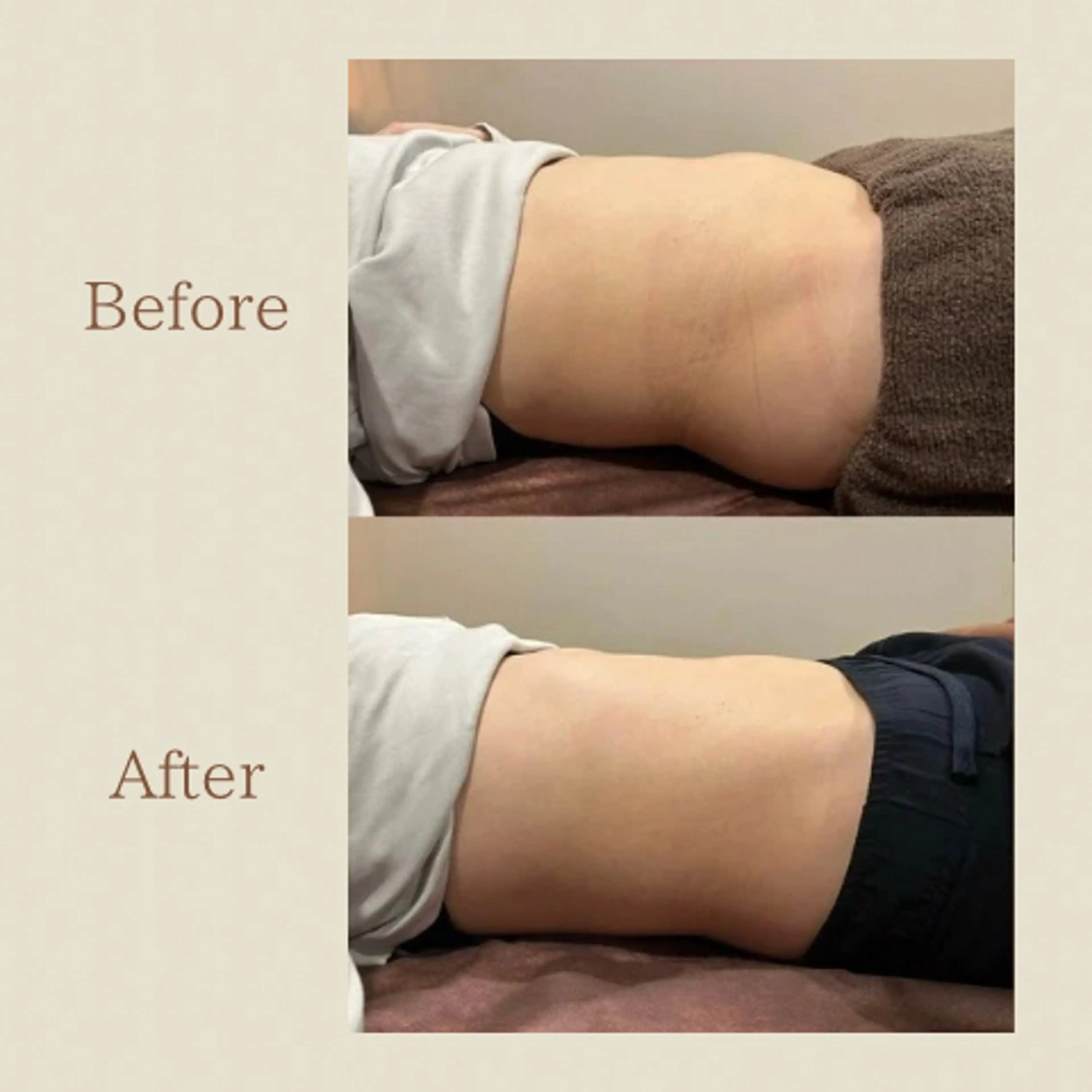 お腹痩せエステ Flat BELLY 恵比寿所属・【腸もみ/脂肪冷却】 お腹エステ/恵比寿のエステ・リラクイメージ