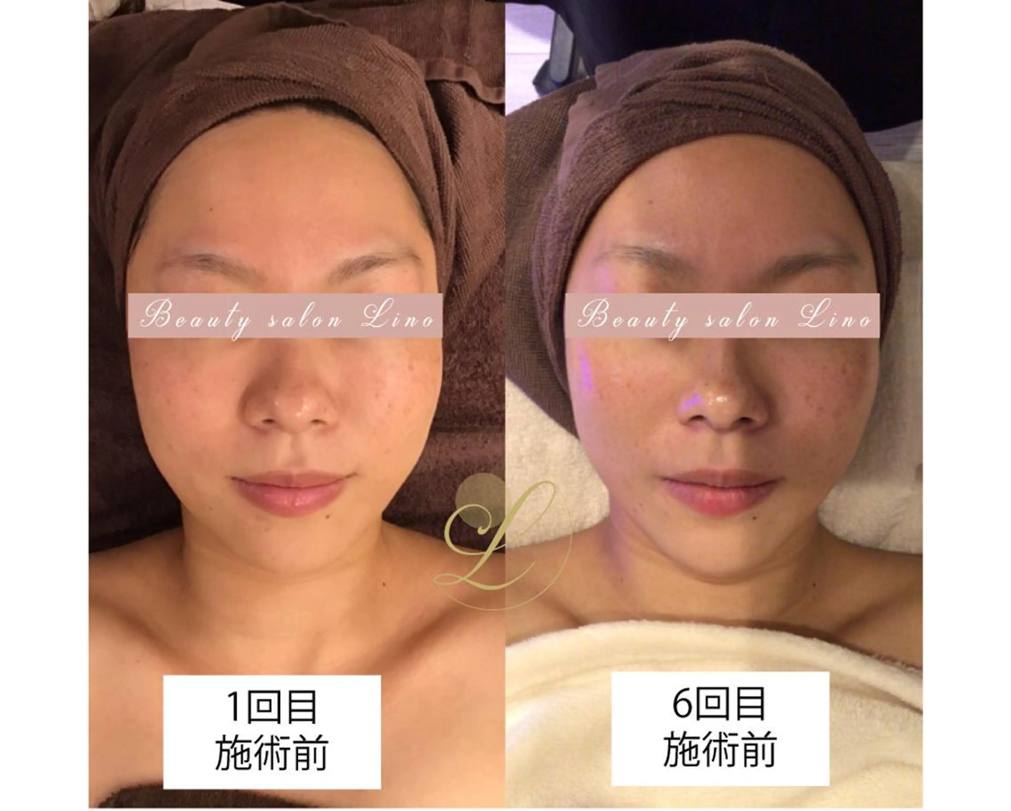 痩身×フェイシャル ブライダル|Linoのエステ・リラクイメージ