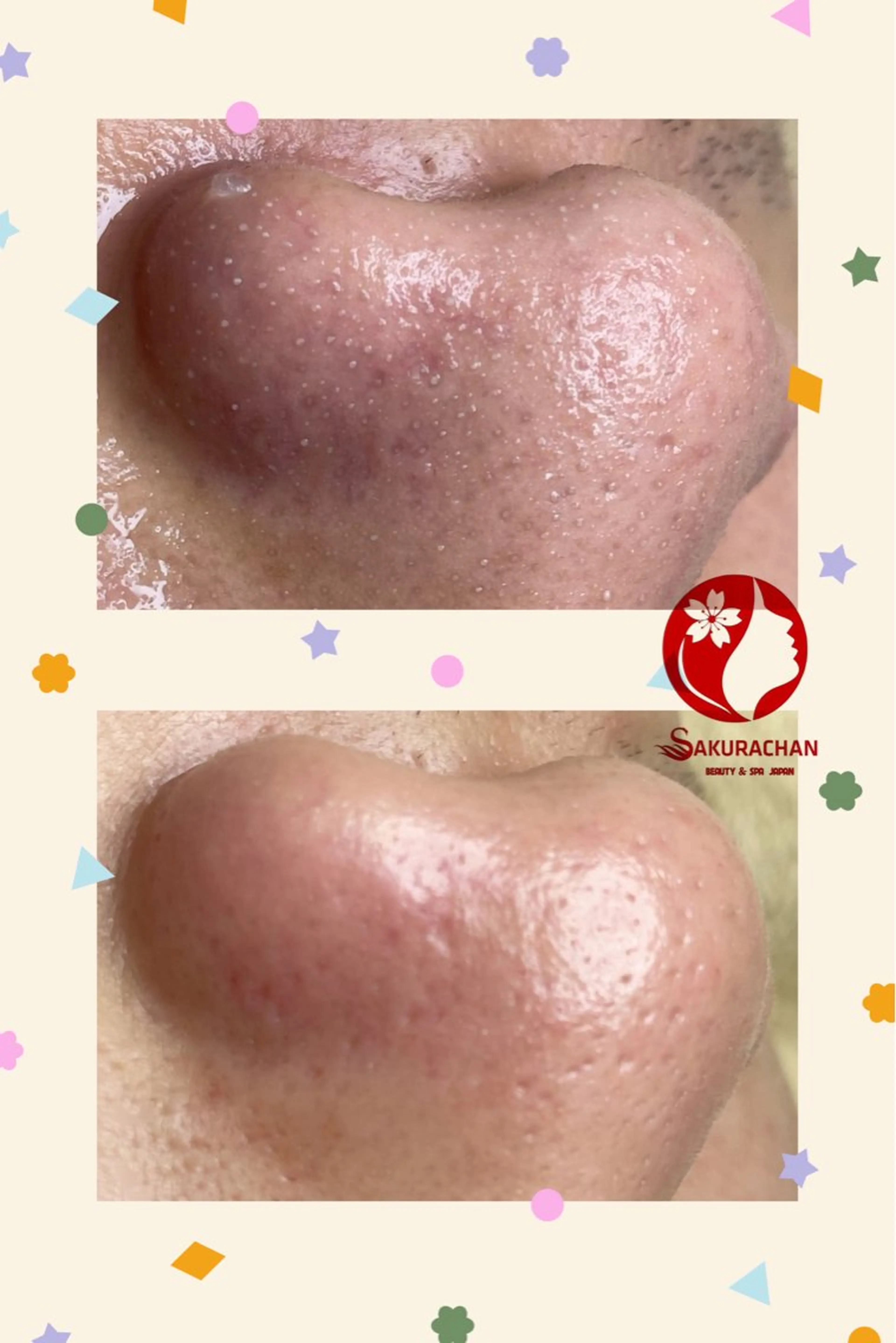 ニキビ、痩身、脱毛、 サクラチャンスパのエステ・リラクイメージ