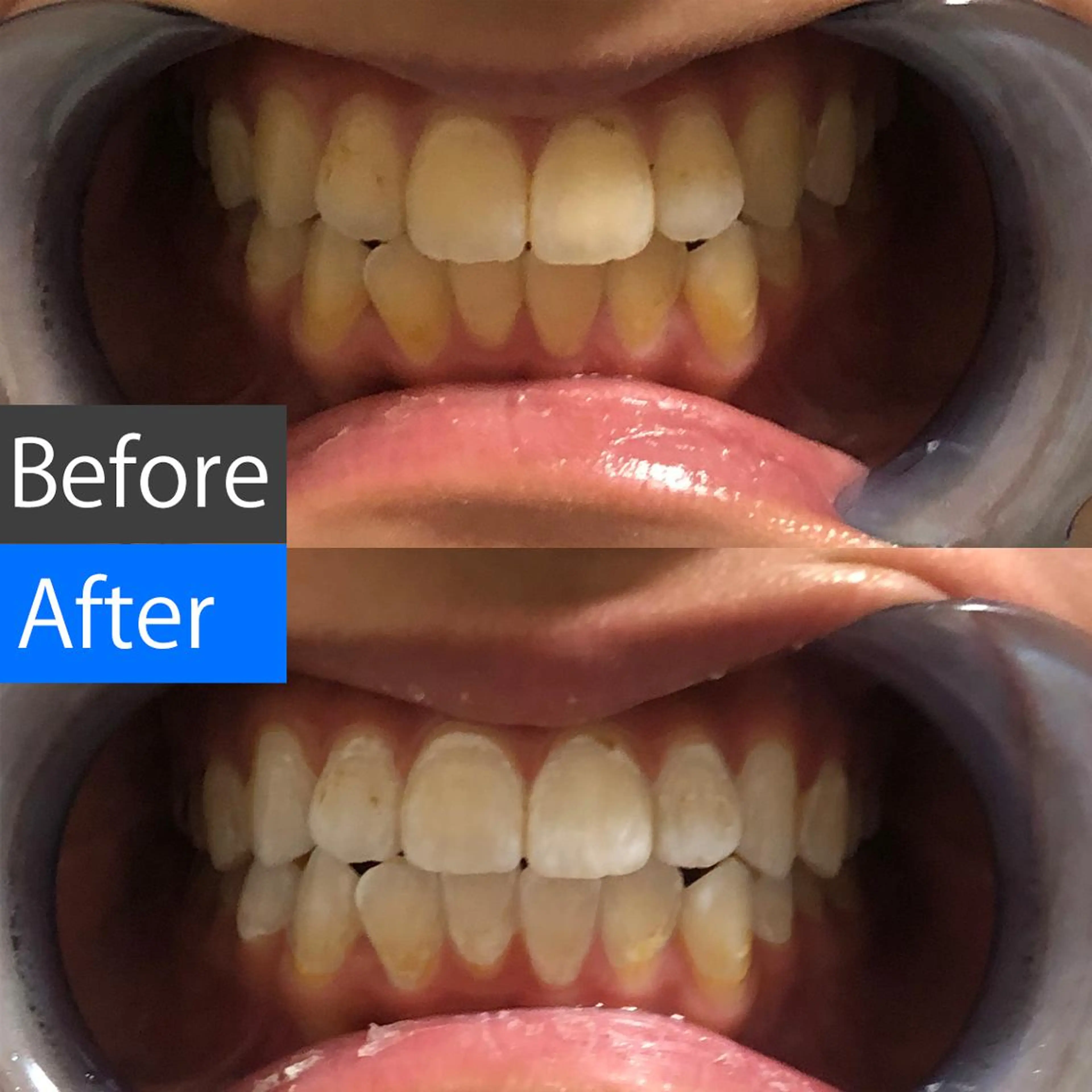 ミディアム カラー キッズ パーマ ネイル ヘアアレンジ マツエク・マツパ メンズ アイブロウ 結婚式・ブライダル メンズ就活ヘア 結婚式・ブライダル オフィスネイル ブライダルネイル 中目黒 ホワイトニングサロンのその他イメージ