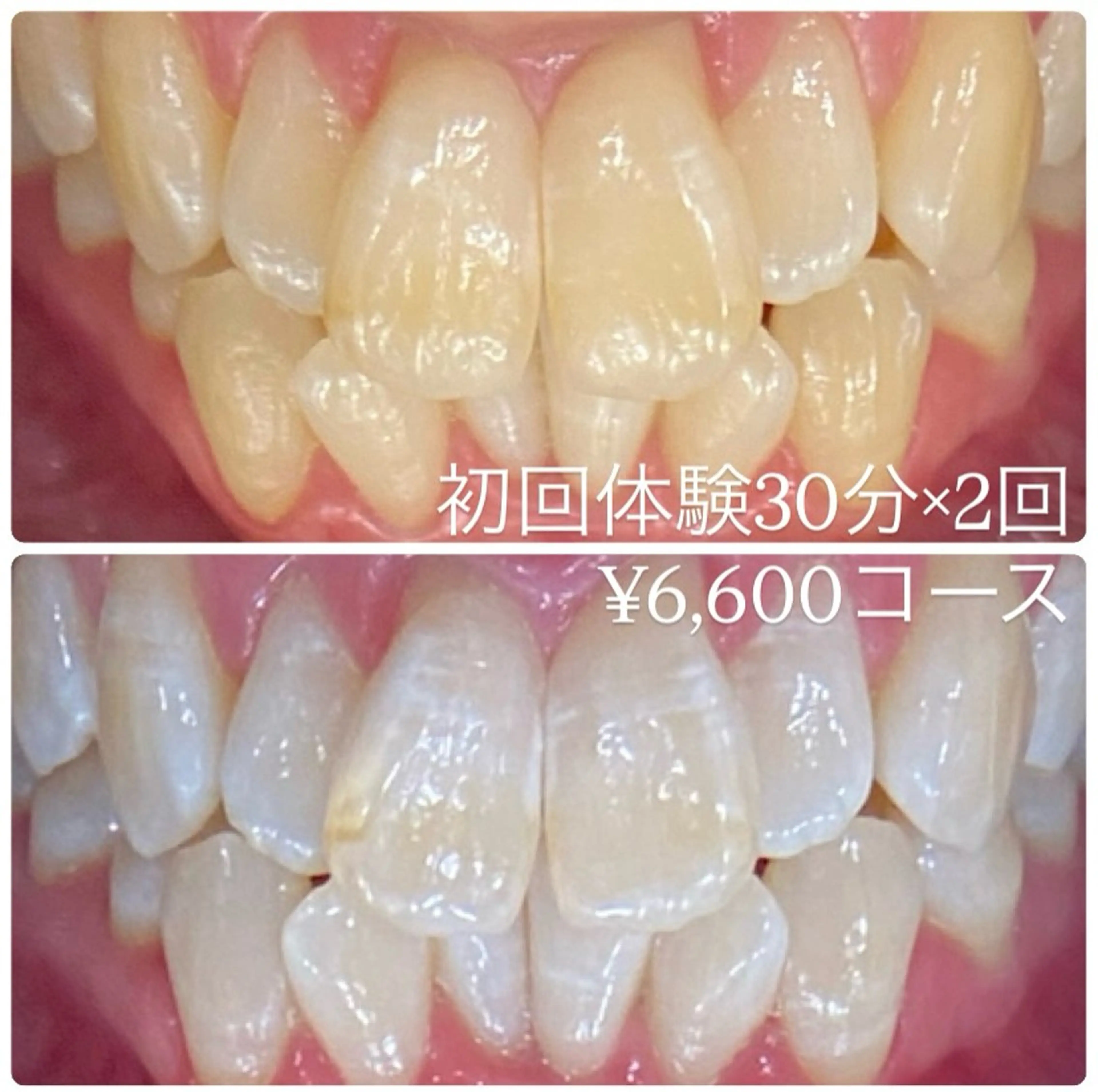 PLATINUM Beauty 横浜店所属・ホワイトニングルーム 横浜店のその他イメージ