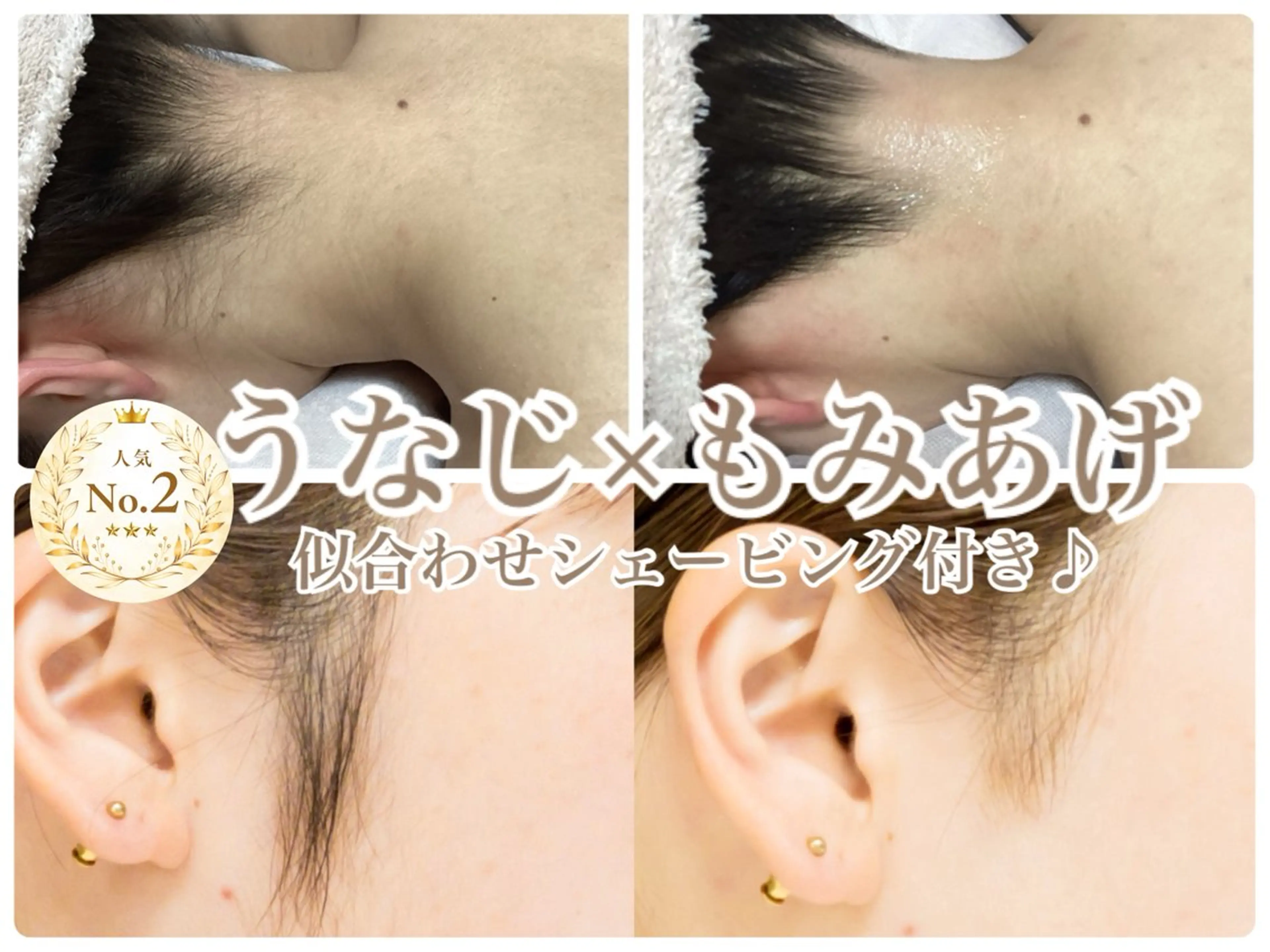 【NO2★】《女性◆IPL脱毛》うなじ×もみあげ脱毛＋似合せシェービング🪒¥4980の写真