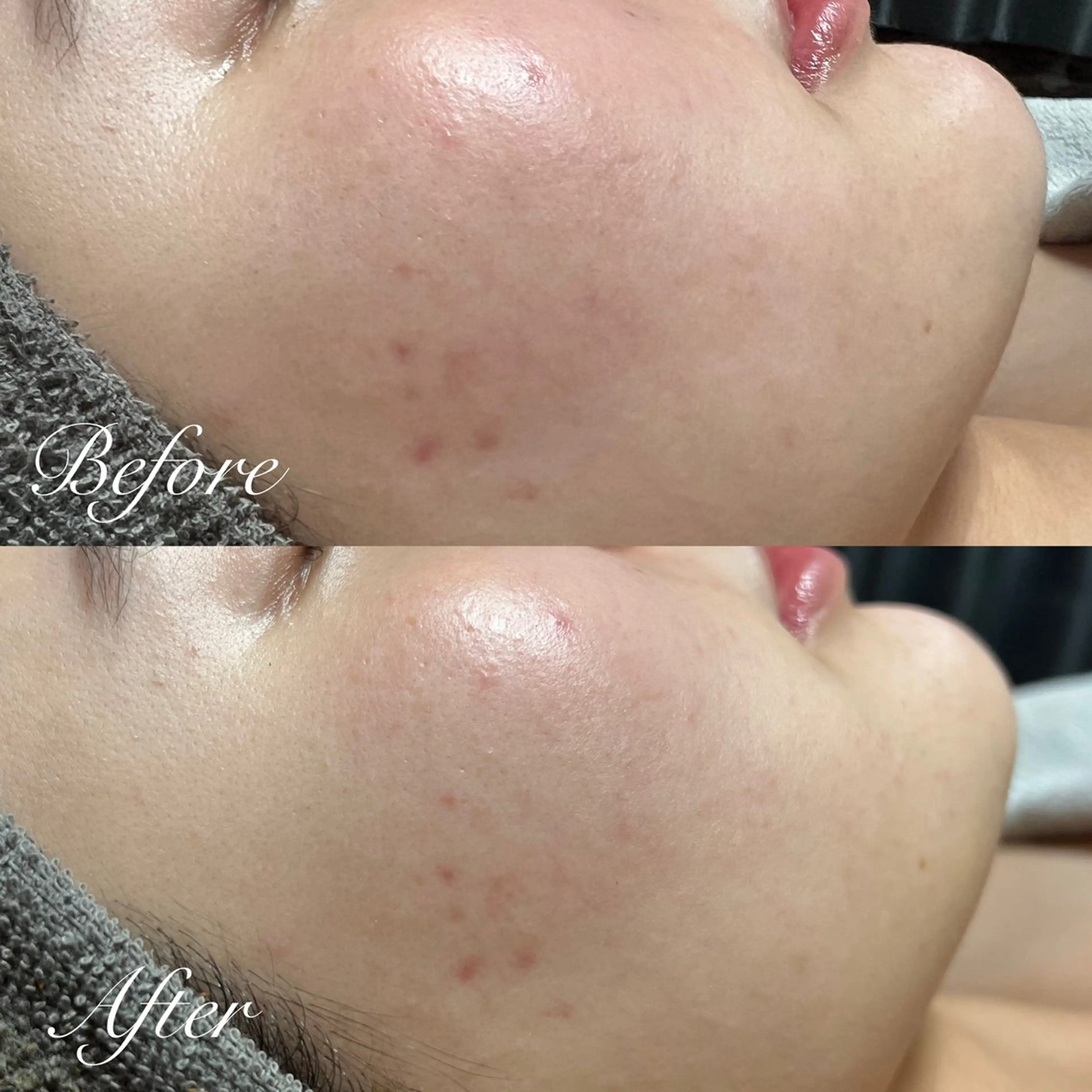 エステ シミ🩷ニキビ専門店 Matteo🎀✨のエステ・リラクイメージ