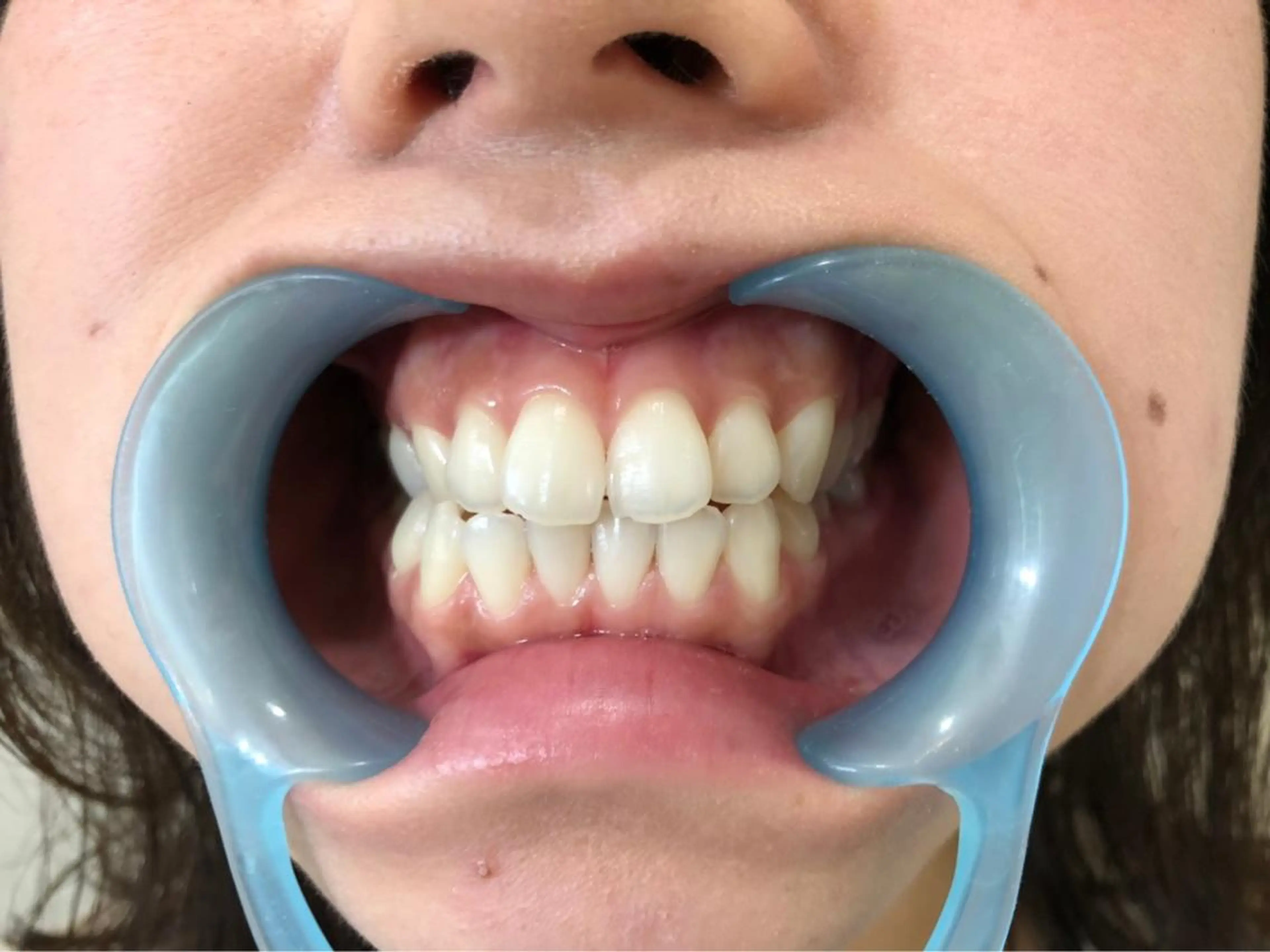 メンズ その他 セルフホワイトニングサロン ラヴィアン所属・ホワイトニングサロン La vie enのその他イメージ