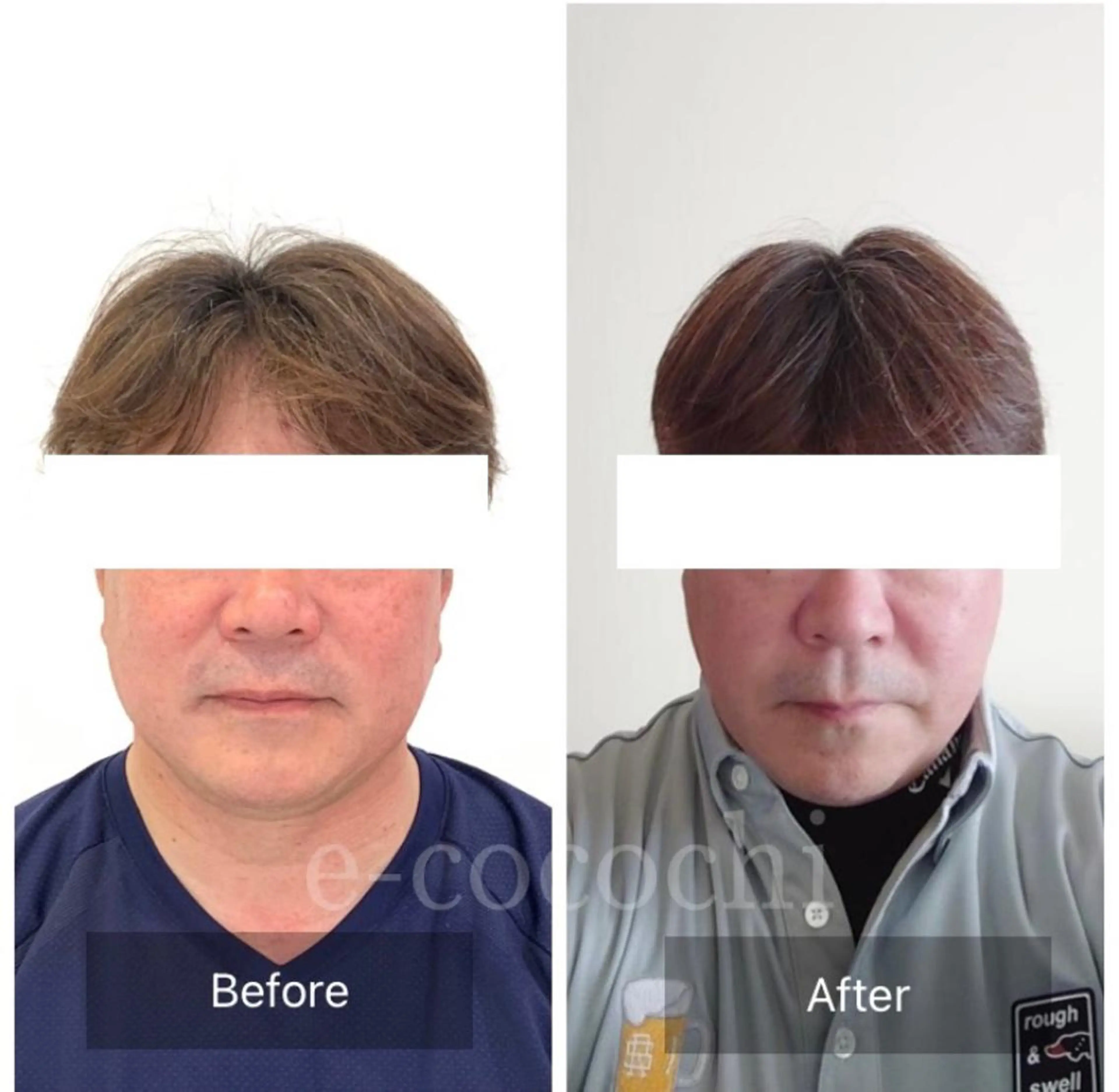 エステ リラク 小顔と ヘッドスパのお店のエステ・リラクイメージ