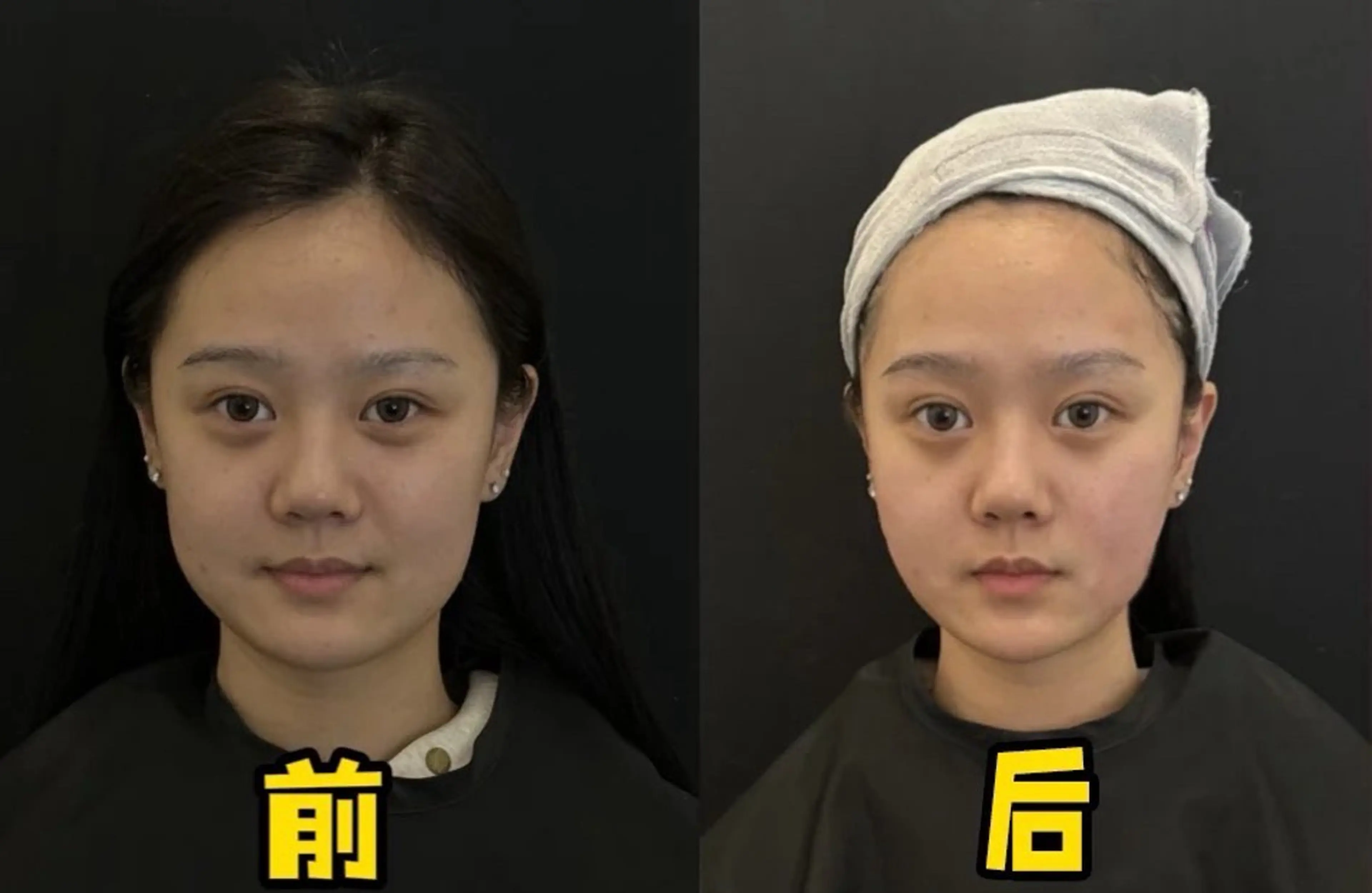 ネイル ブライダルネイル ホワイト エステ aliaハイフ&水光ジェットサロン所属・aliaハーブ水光店 エステティシャン募集のエステ・リラクイメージ