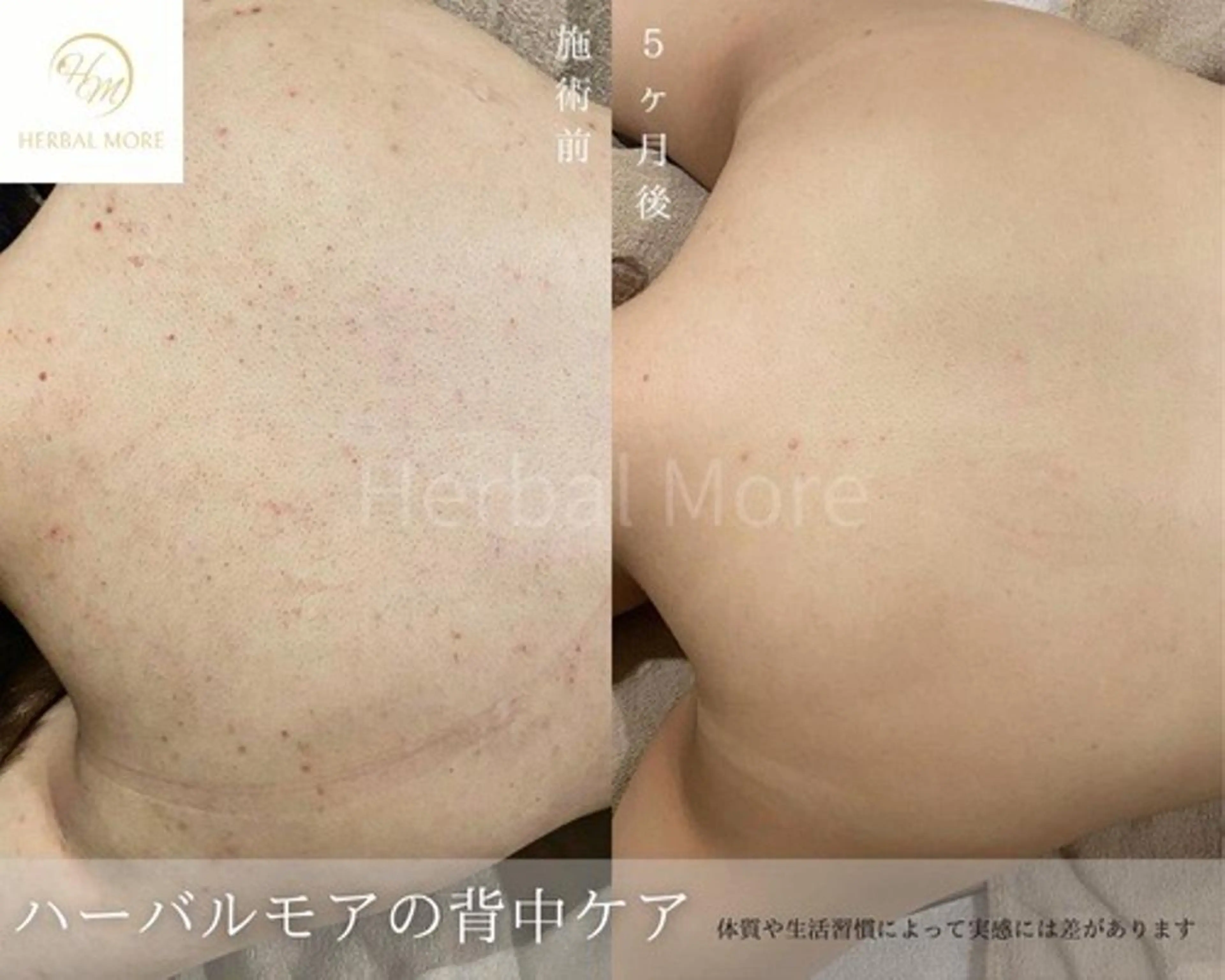 脱毛・眉毛・フェイス サロンN久留米店のその他イメージ